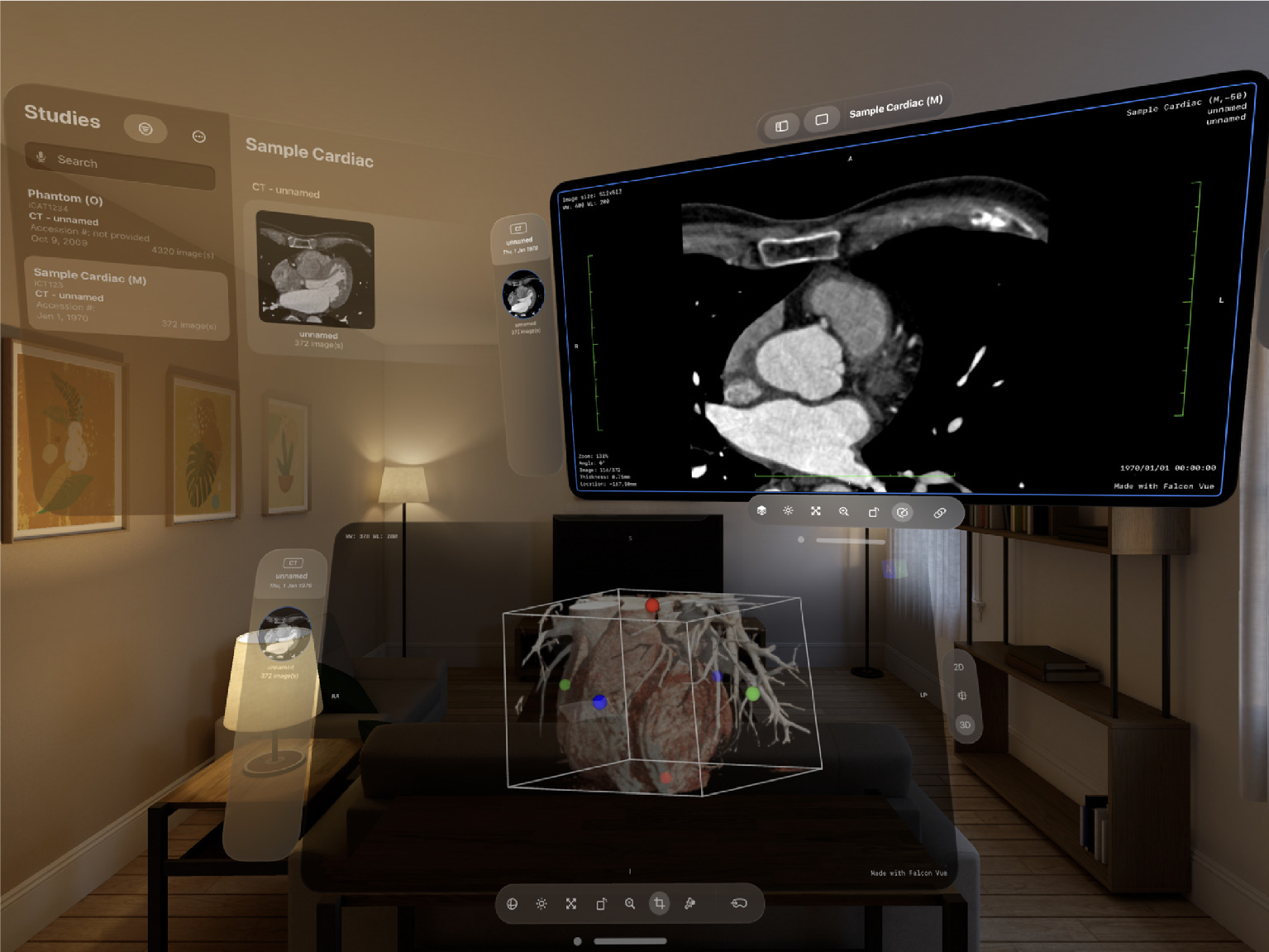 Falcon Vue for the Apple Vision Pro brings DICOM viewing into the spatial realm to create an immersive and interactive experience for radiologists.