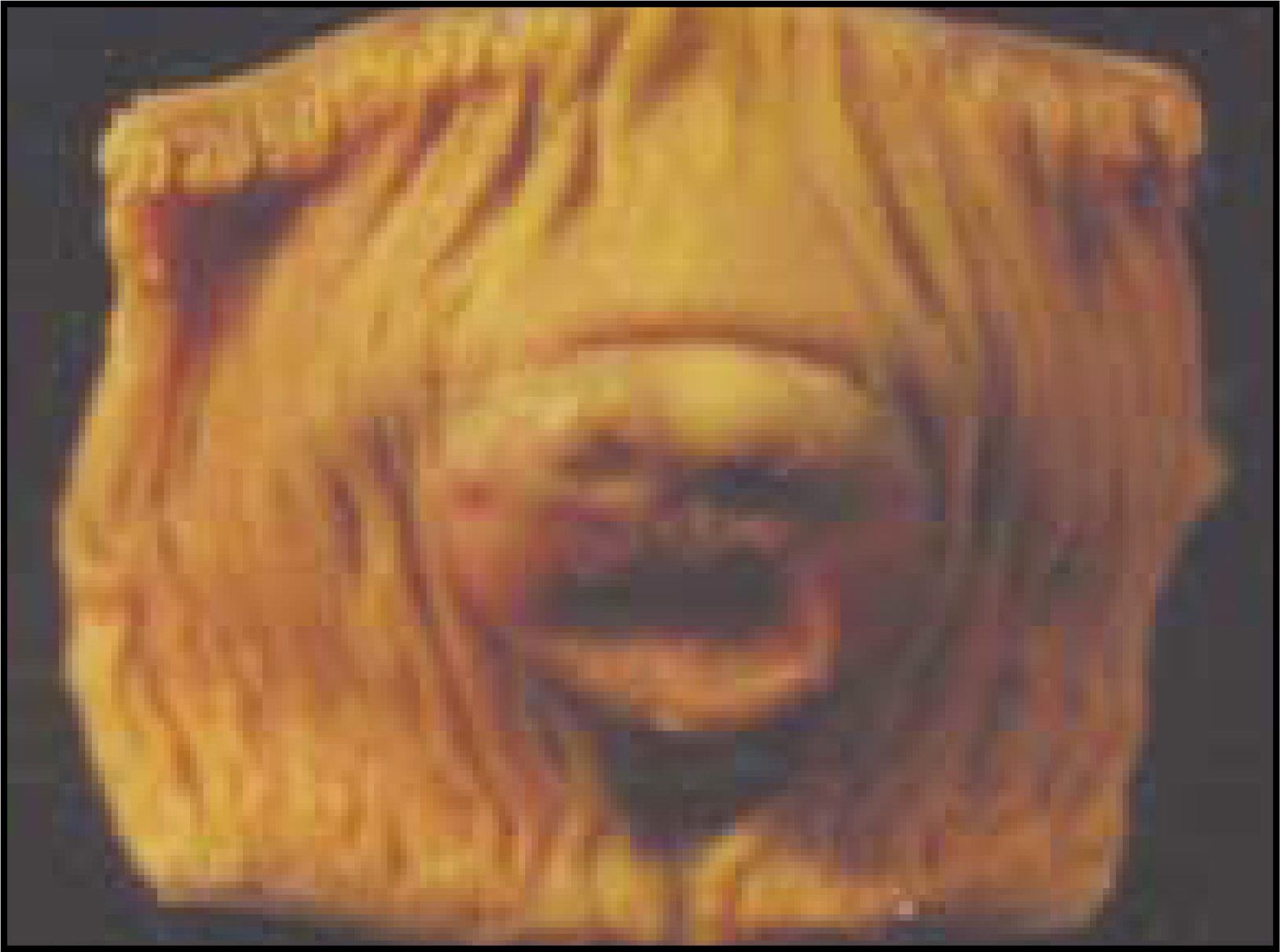 FIGURE 4.
