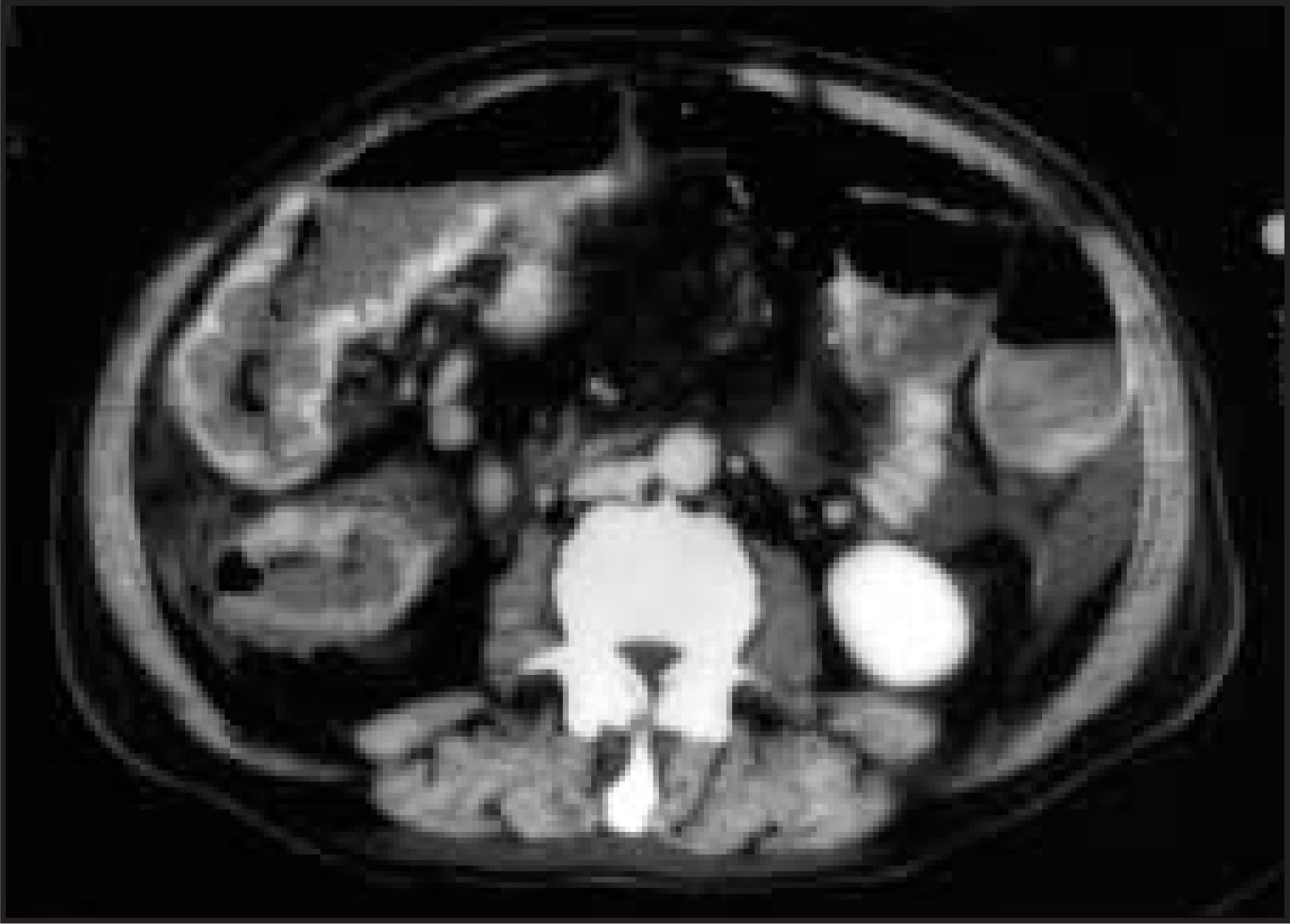 FIGURE 11.