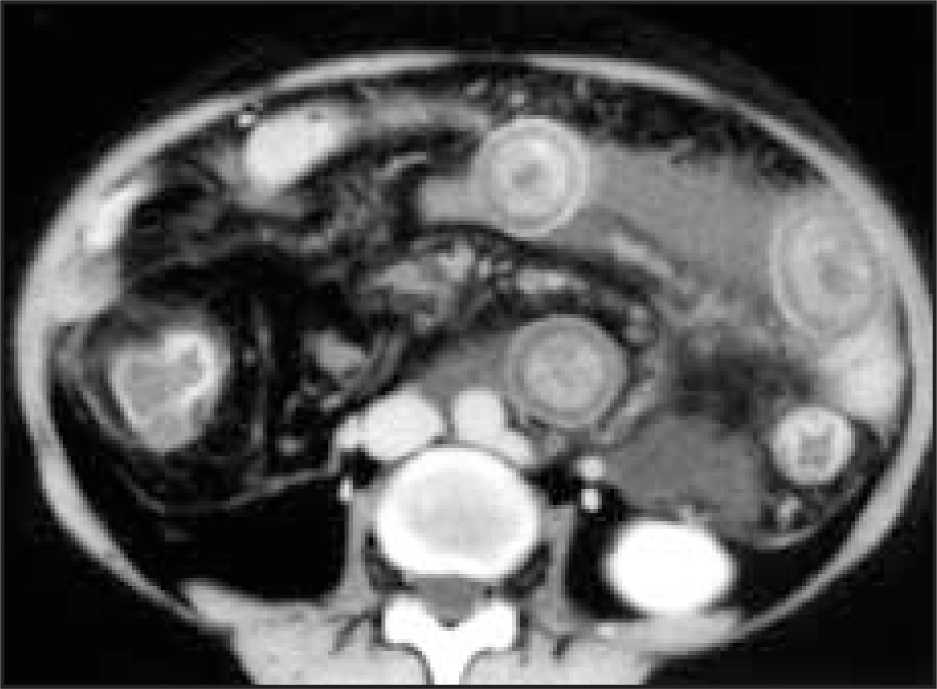 FIGURE 13.