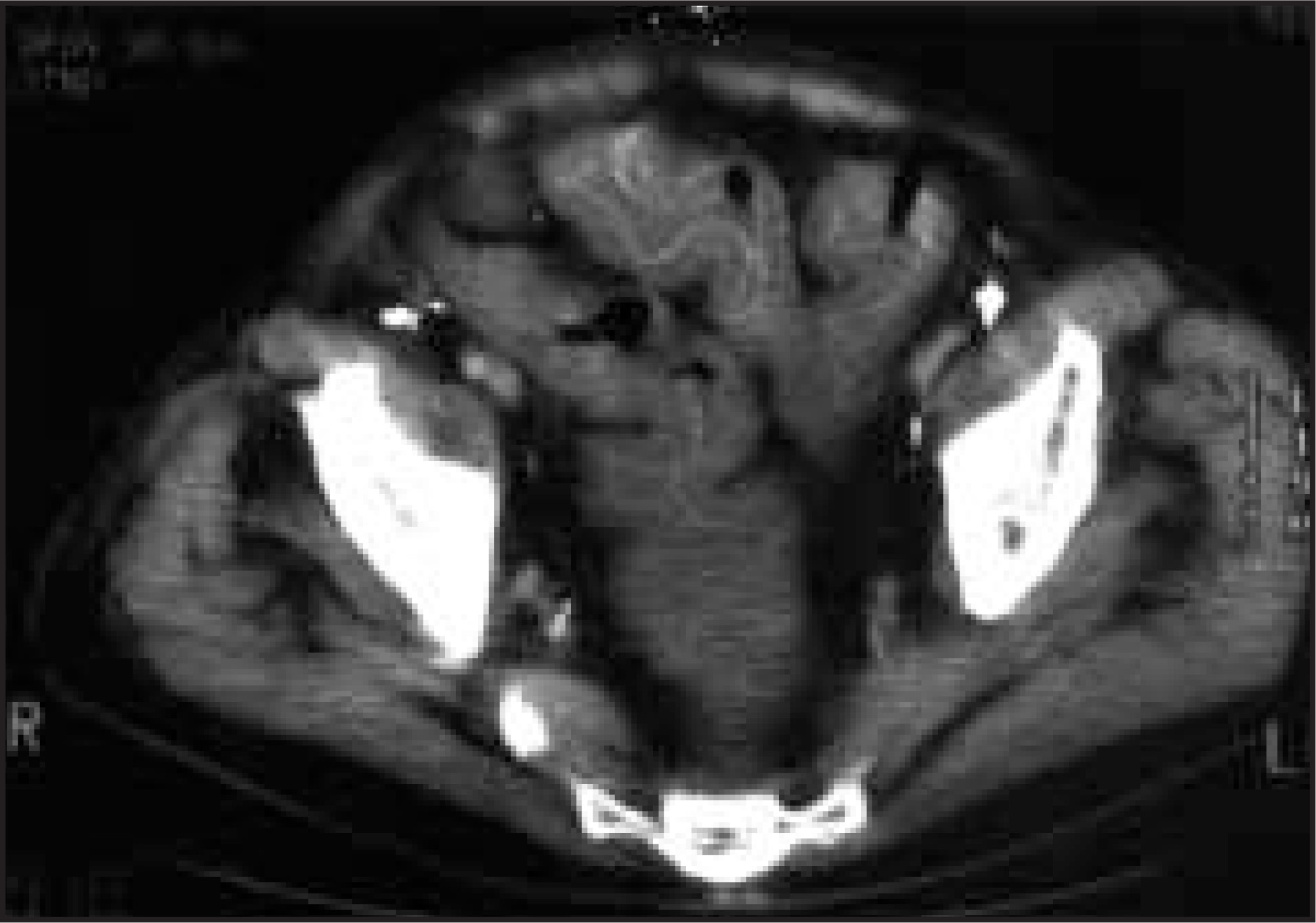 FIGURE 14.