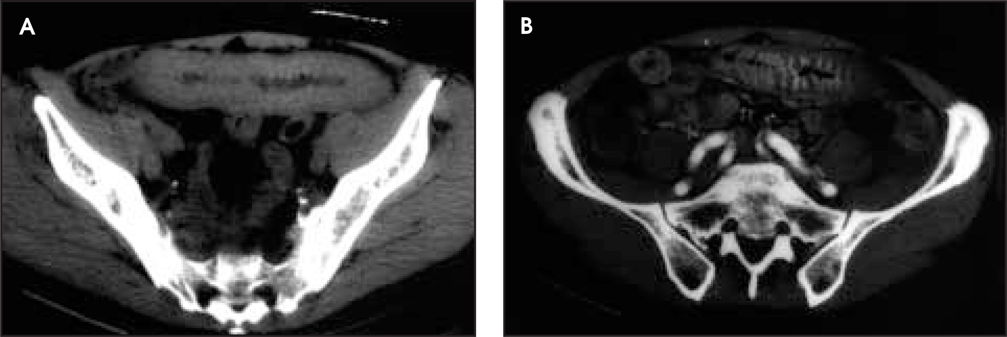 FIGURE 17.