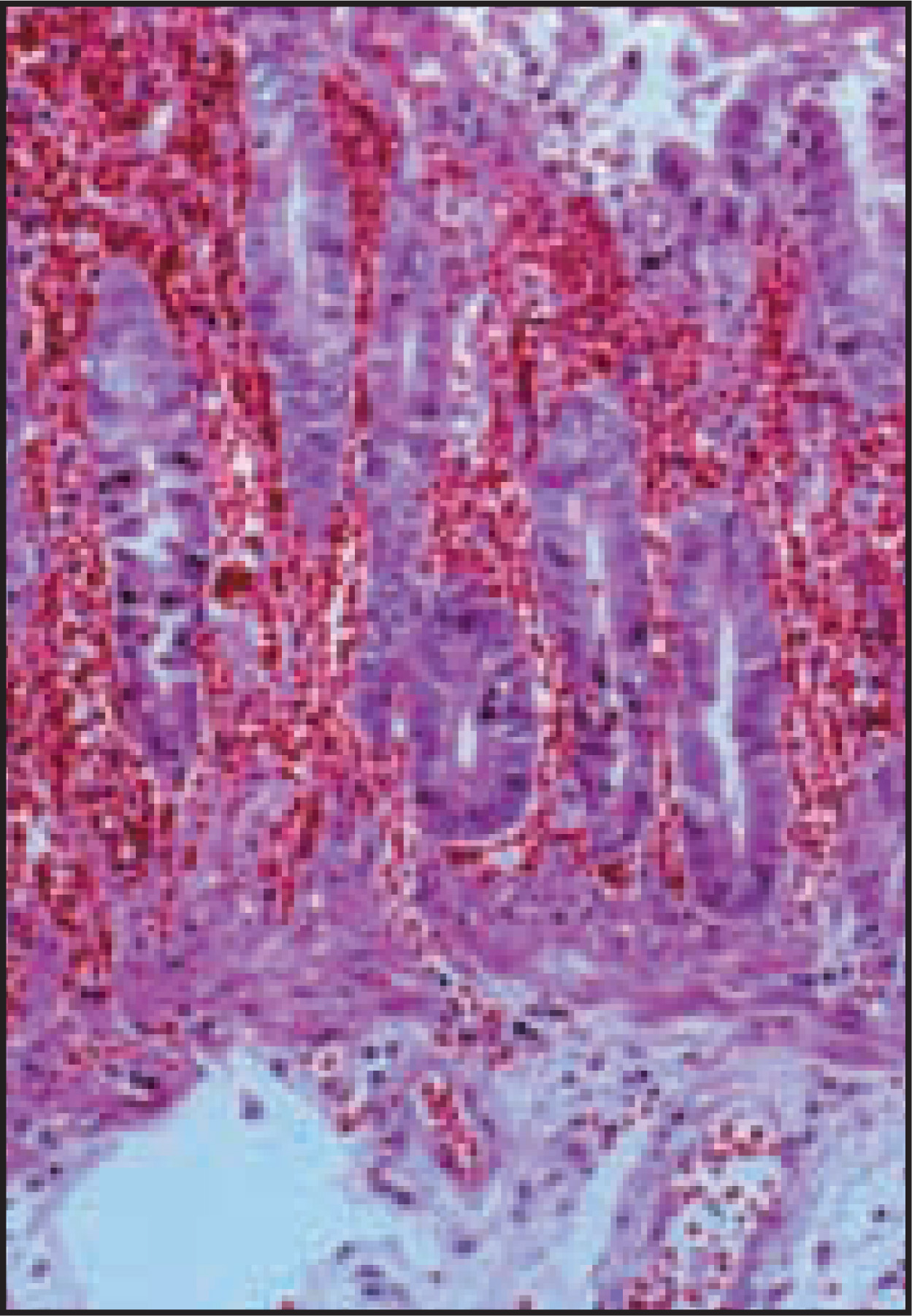FIGURE 18.