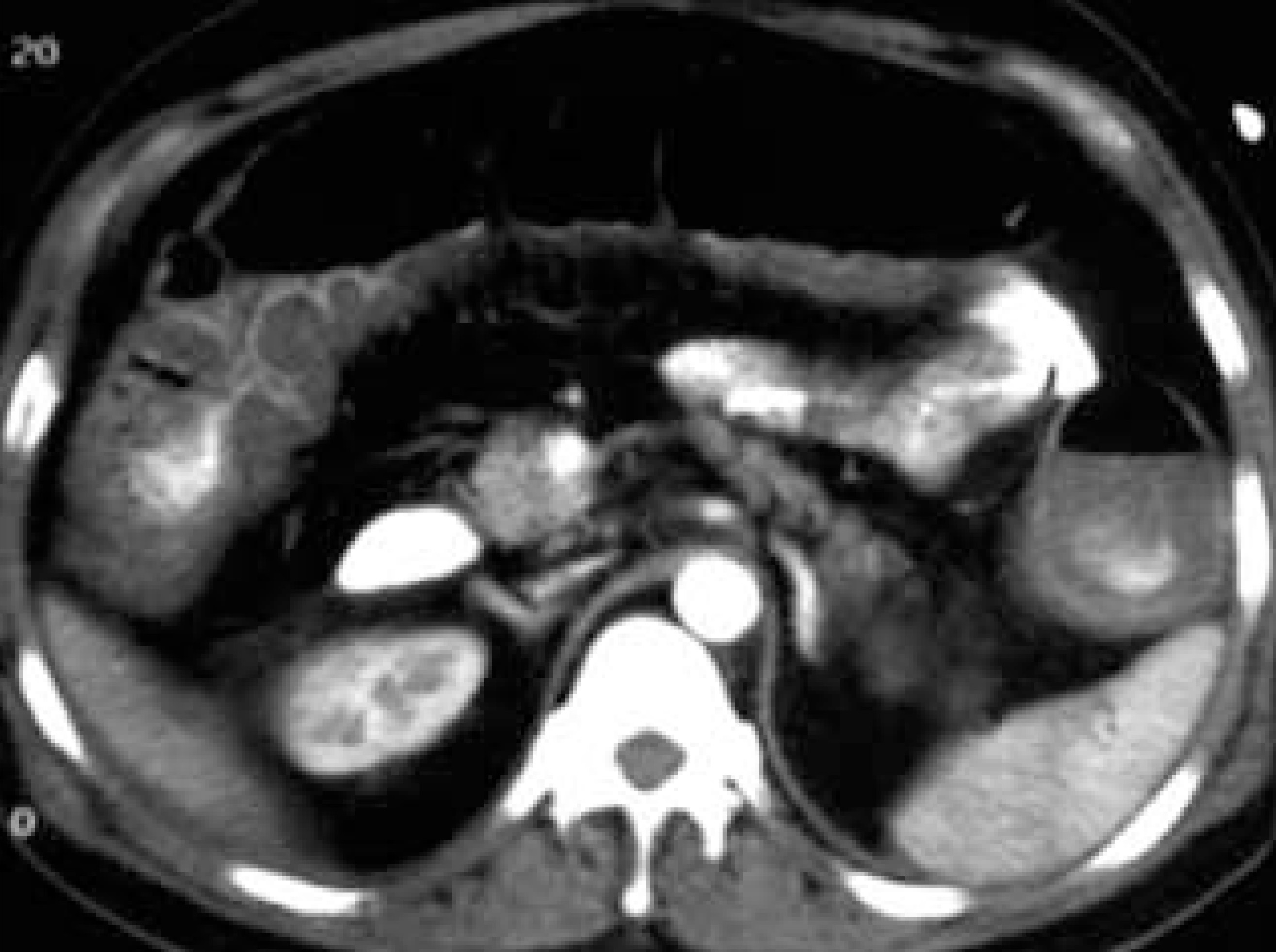 FIGURE 22.