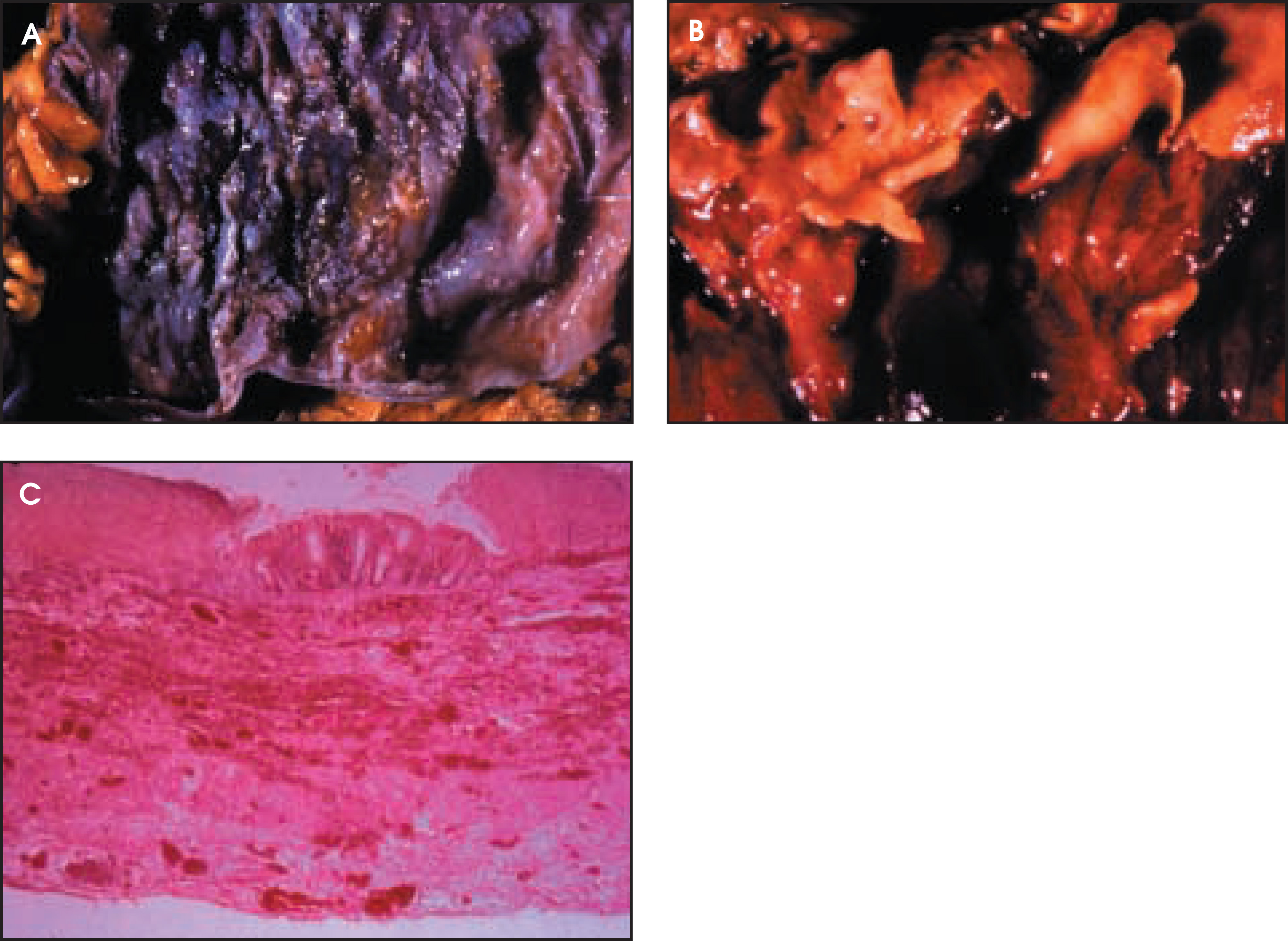 FIGURE 23.