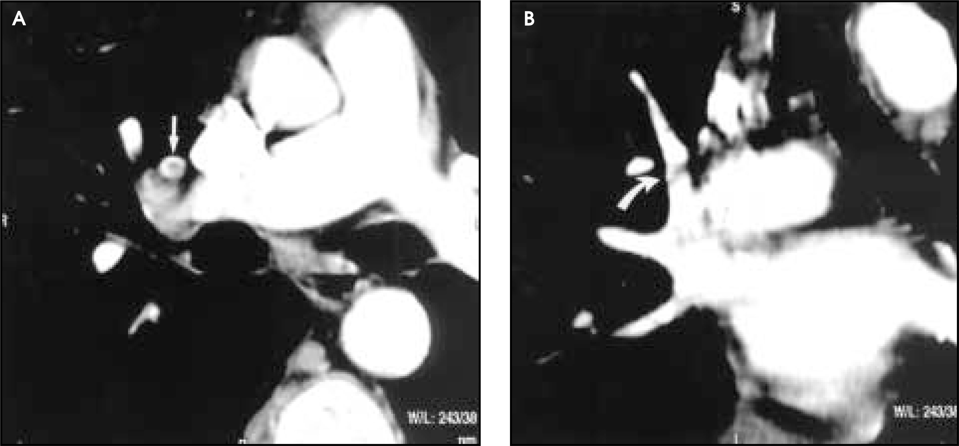 FIGURE 4.