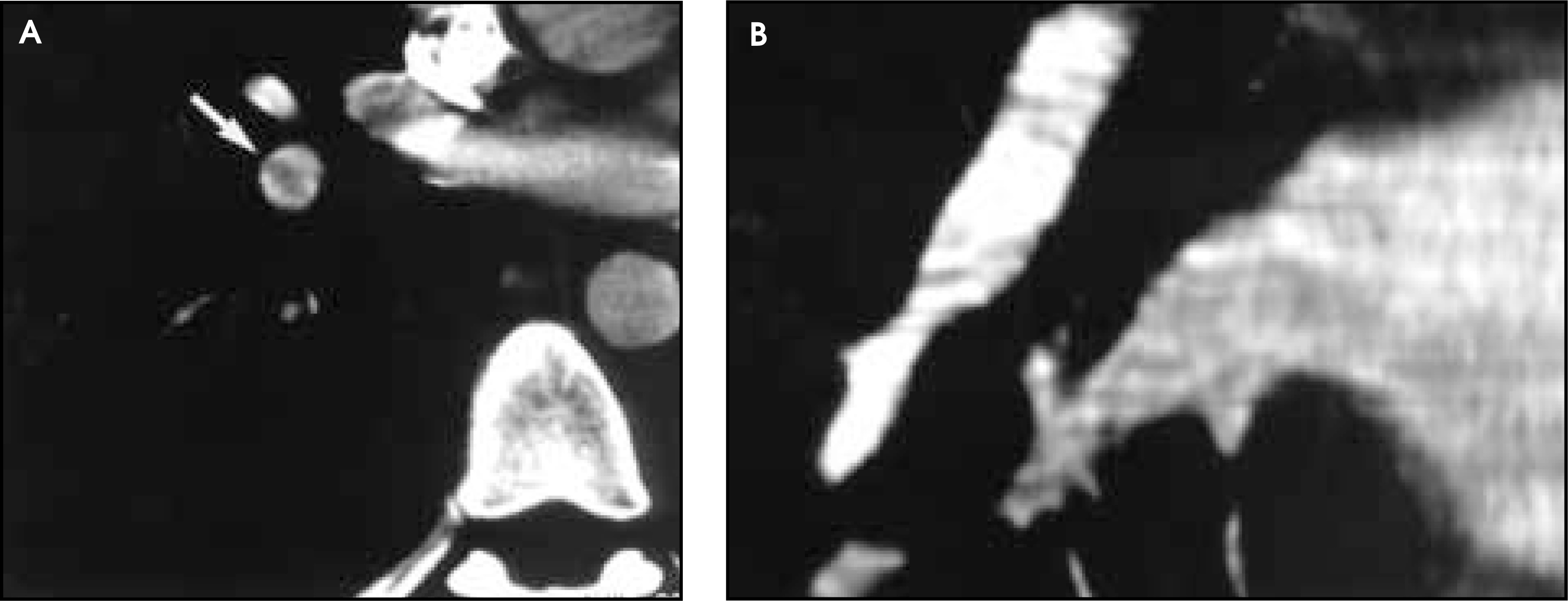 FIGURE 11.