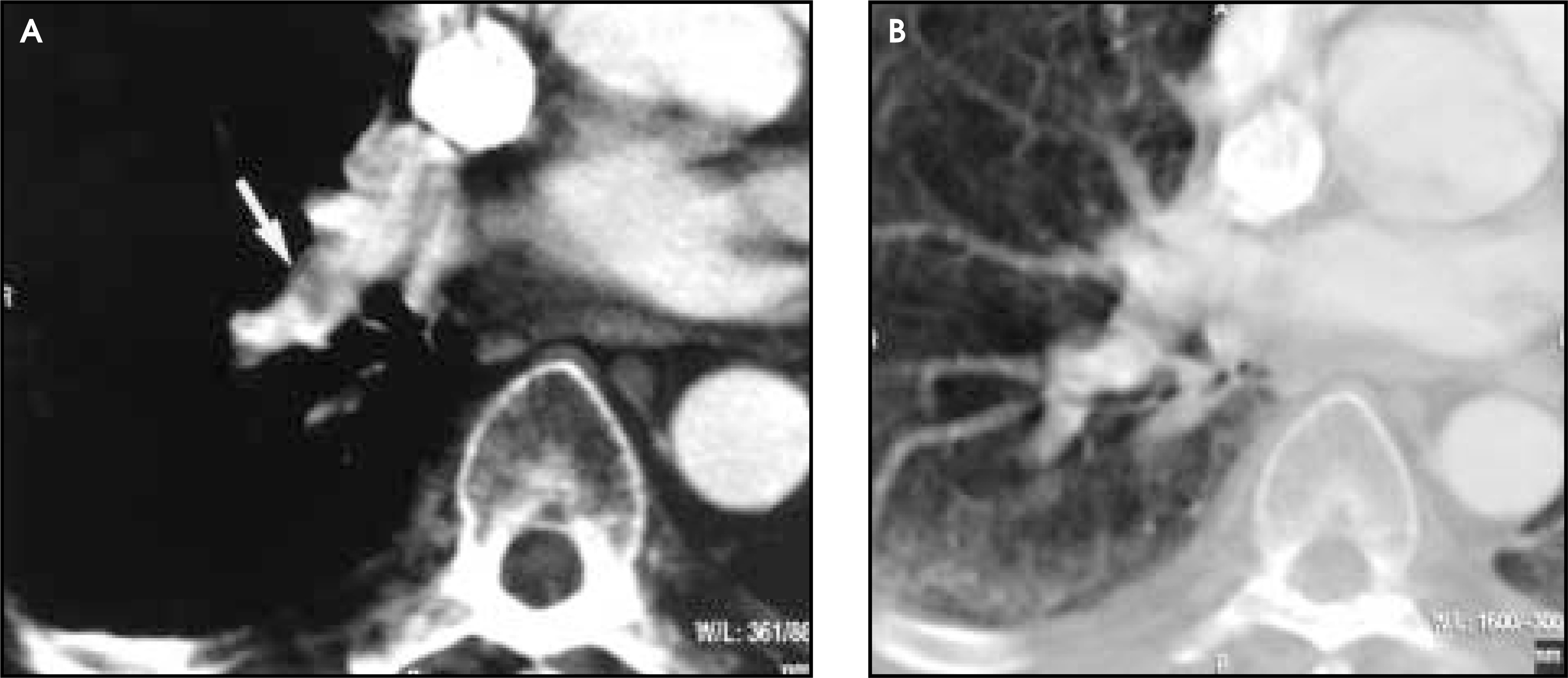 FIGURE 12.