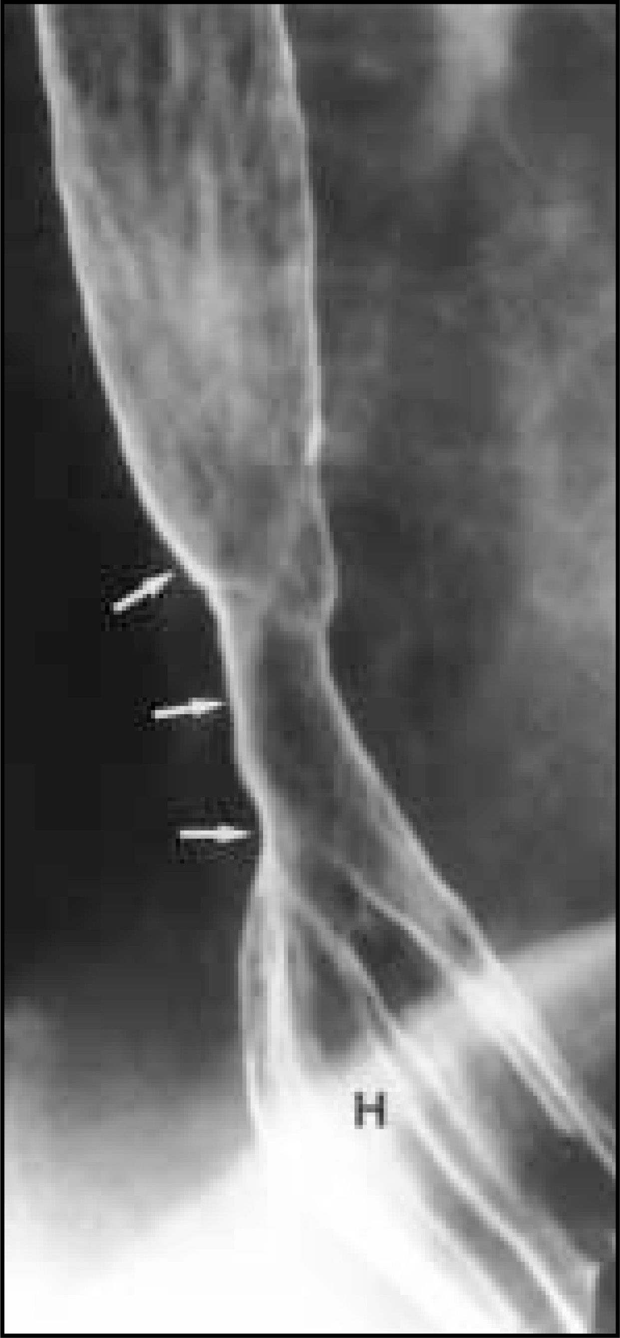 FIGURE 11.