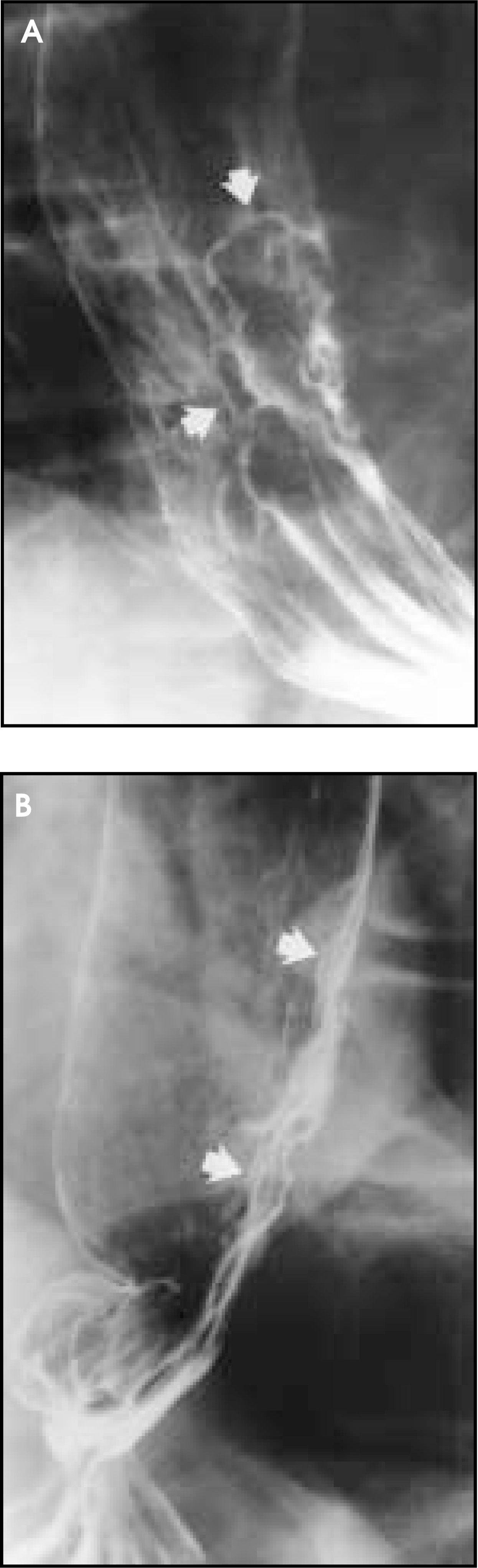 FIGURE 13.