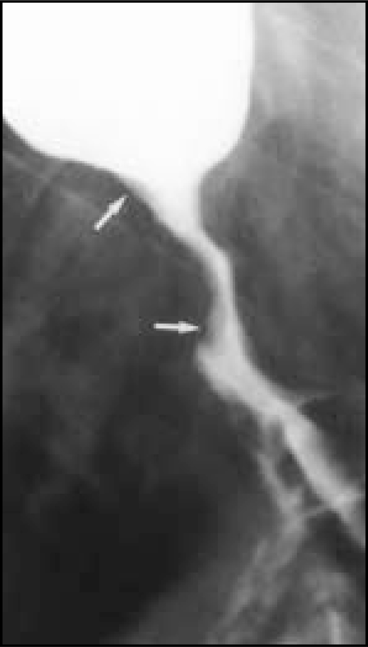 FIGURE 14.