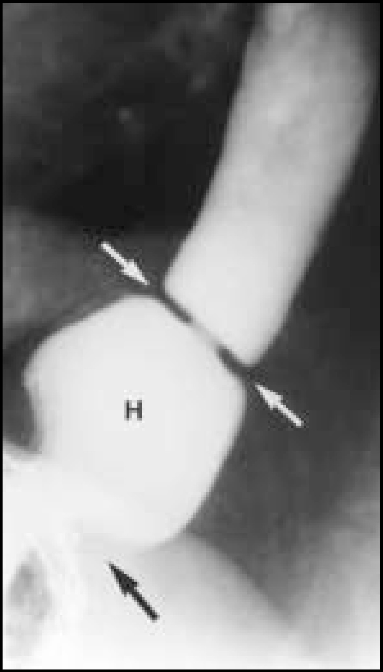 FIGURE 15.