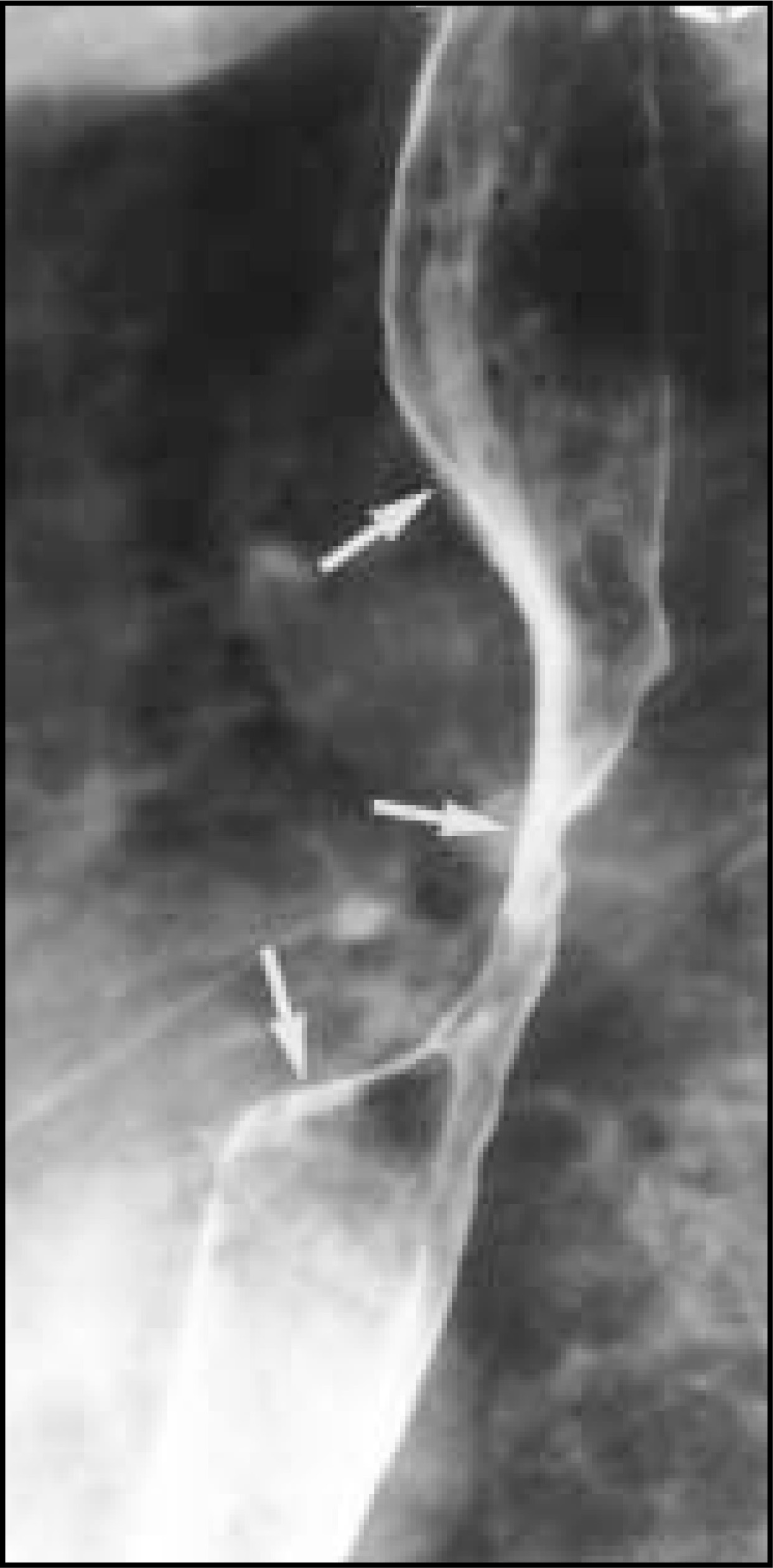 FIGURE 17.