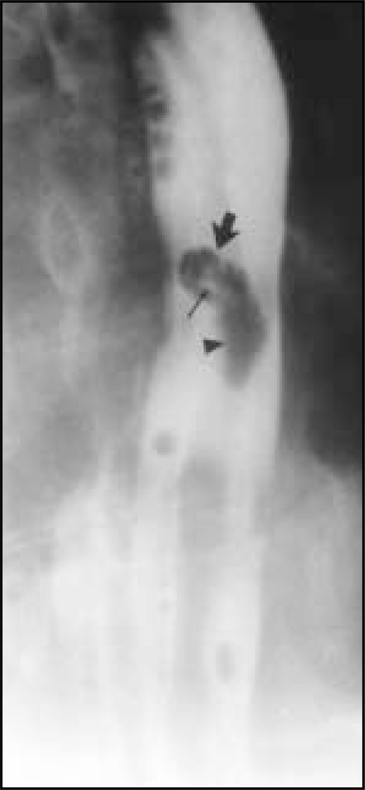 FIGURE 18.