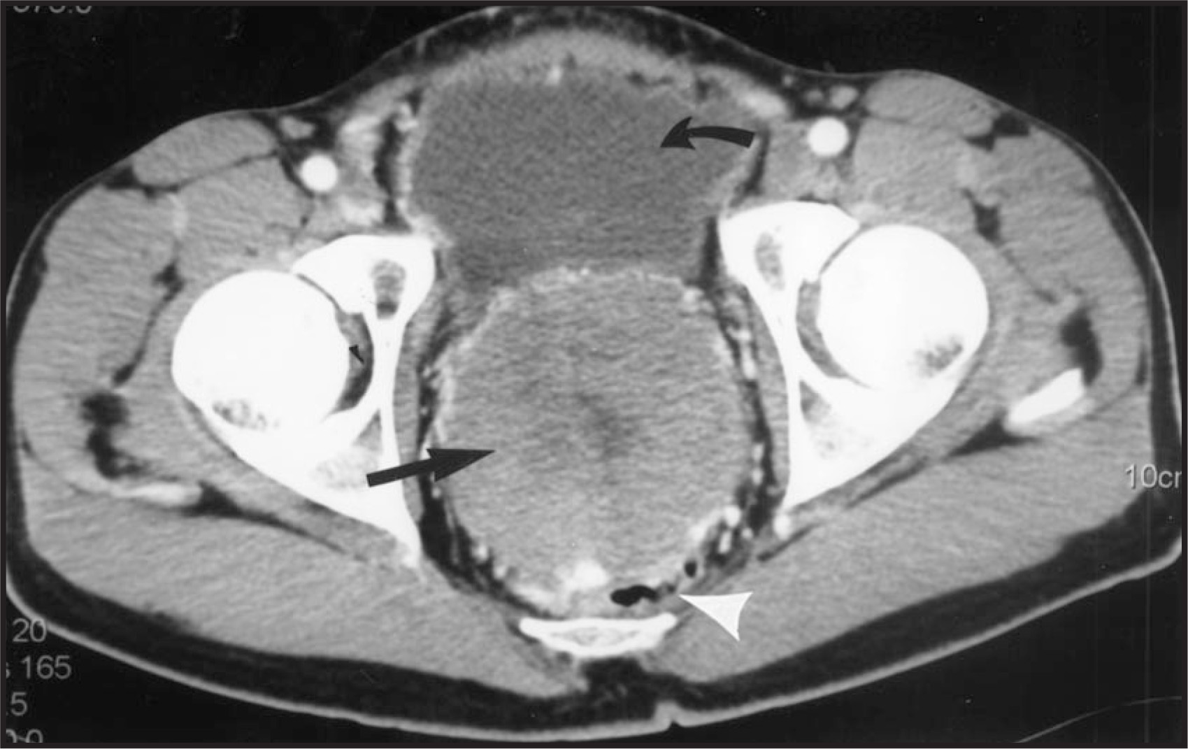 FIGURE 3.