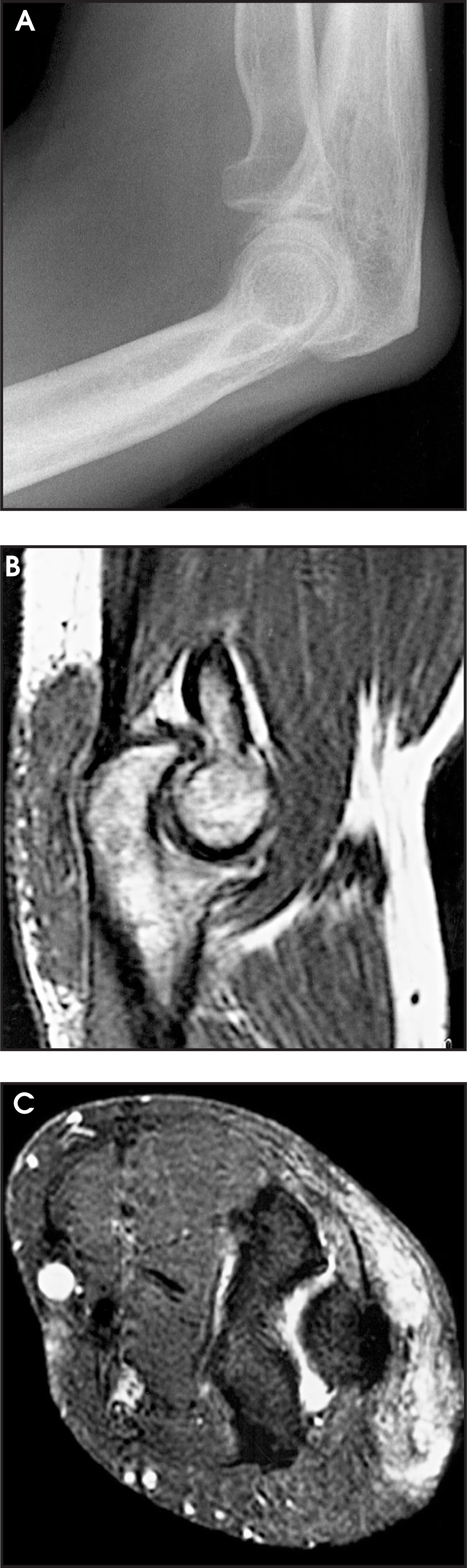 FIGURE 11.