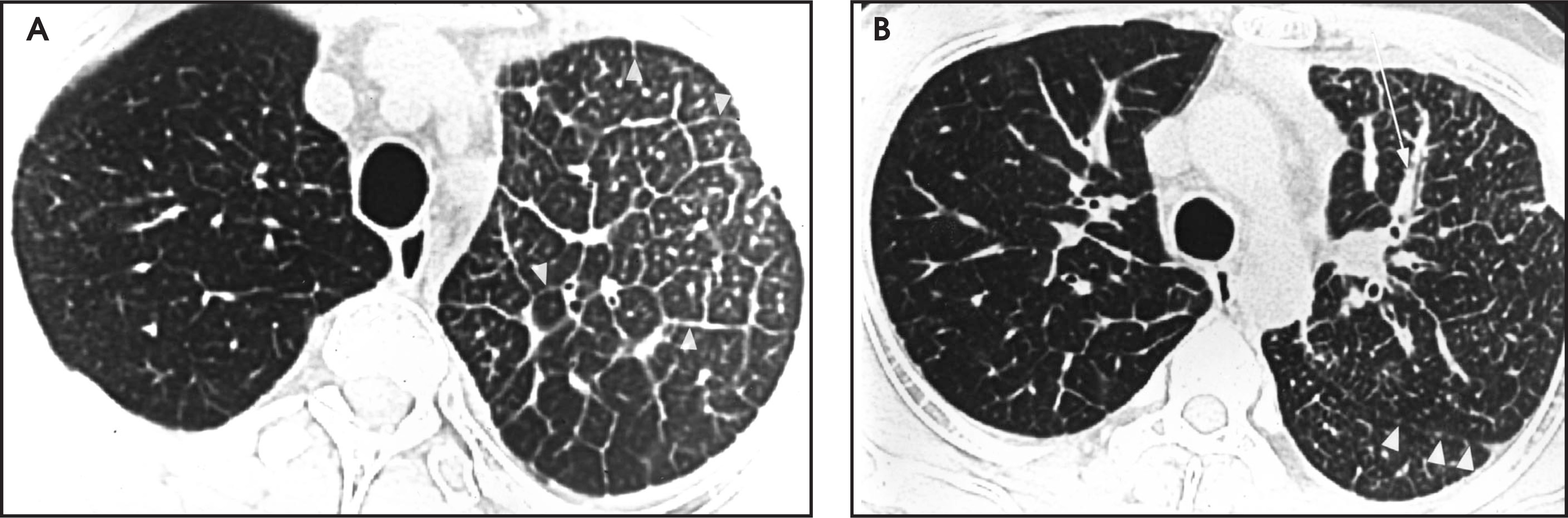 FIGURE 10.