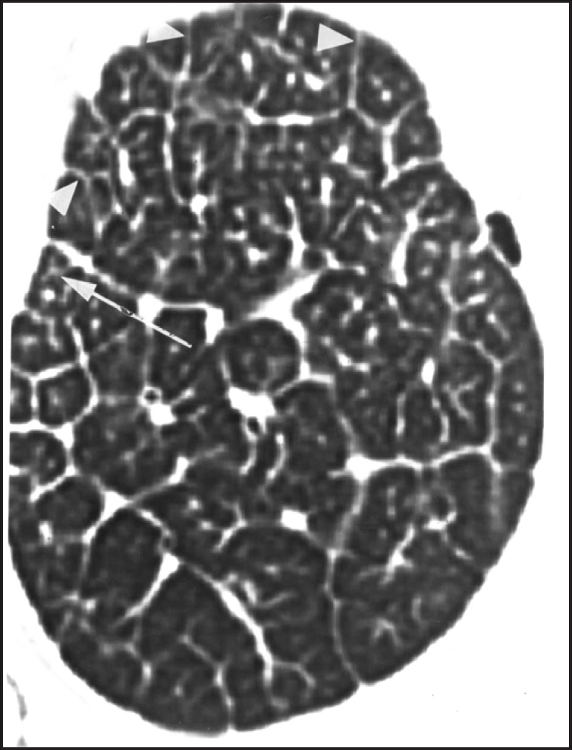 FIGURE 11.