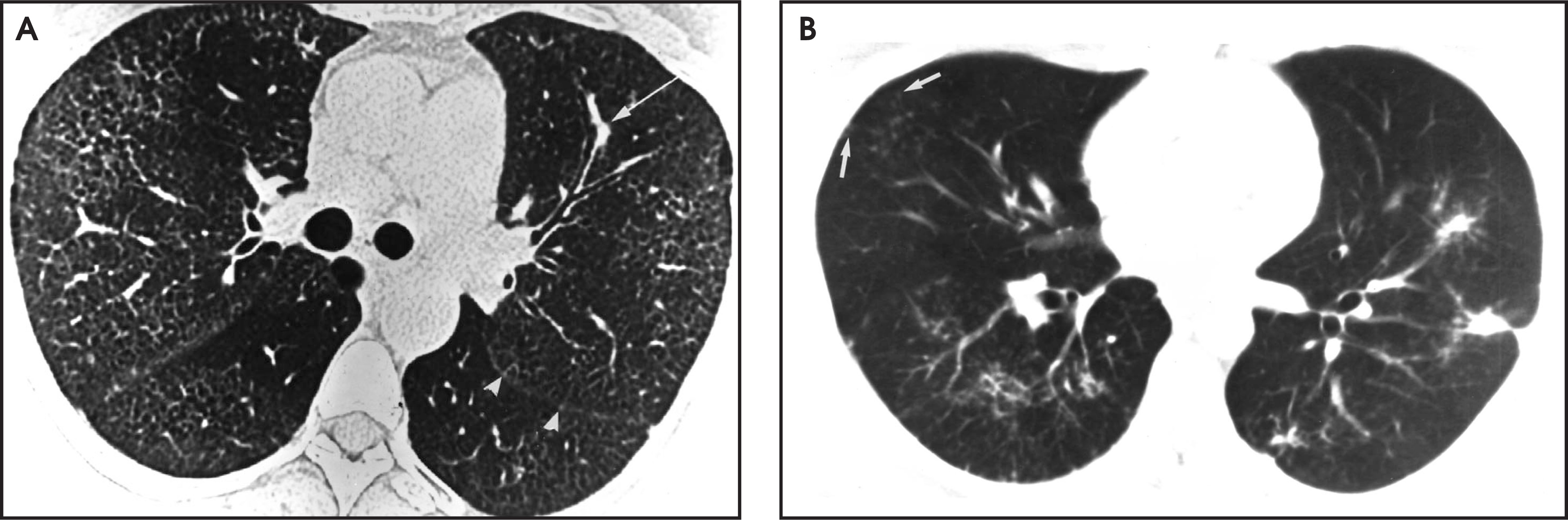 FIGURE 12.