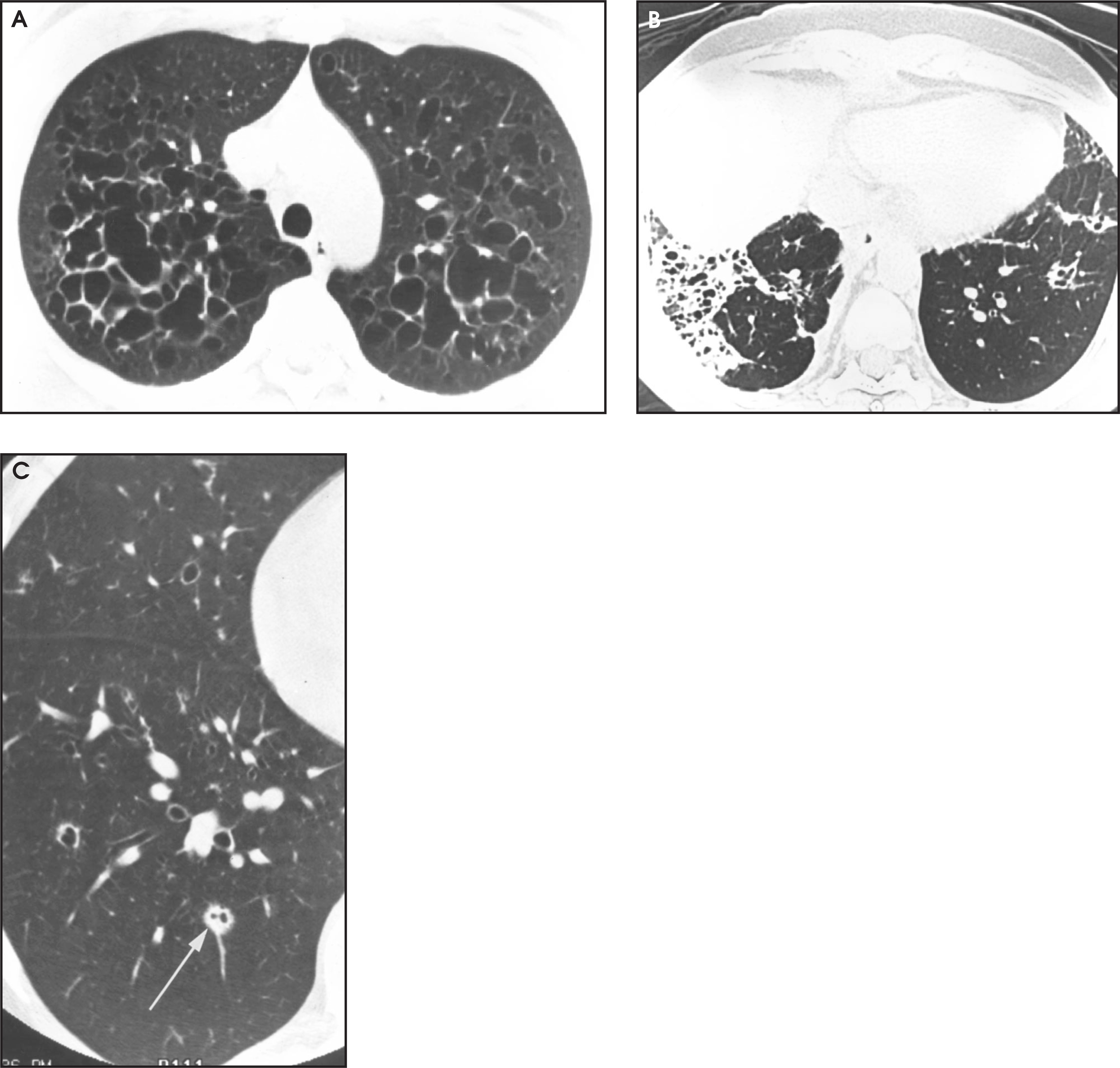 FIGURE 13 .