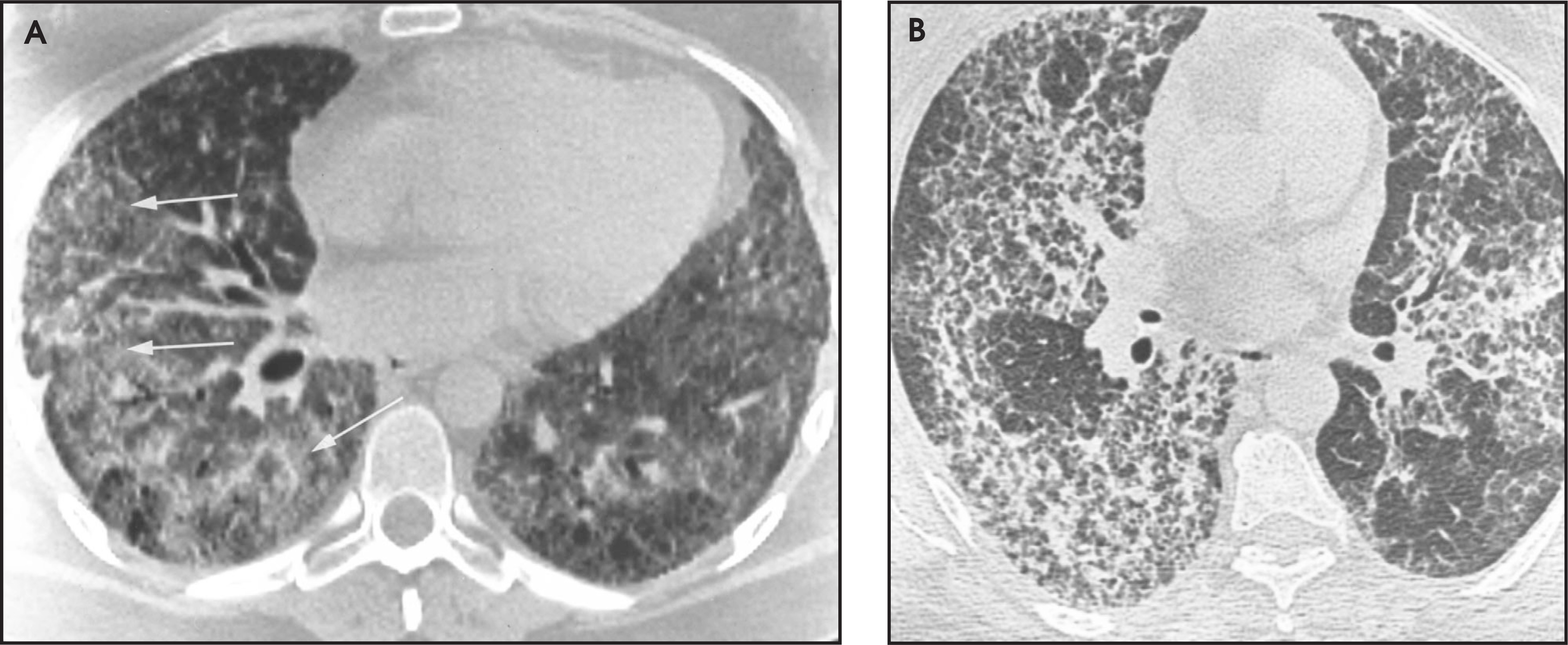 FIGURE 14.