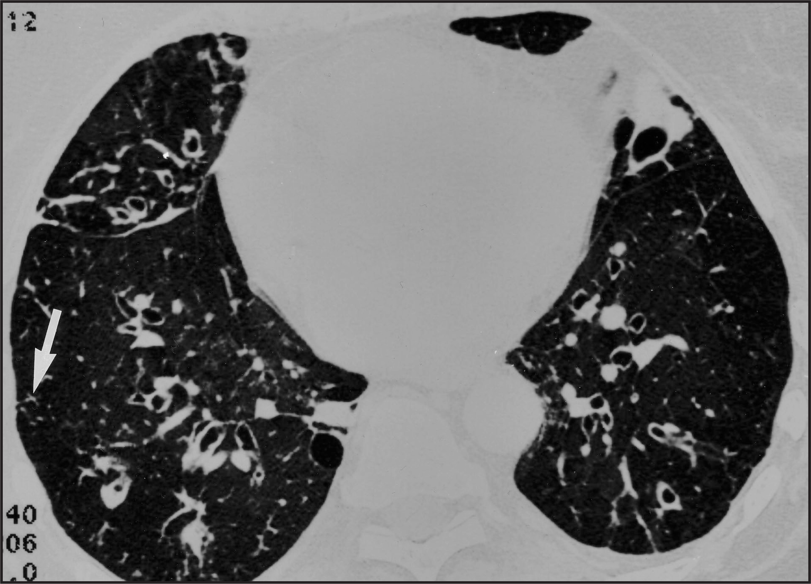 FIGURE 10.