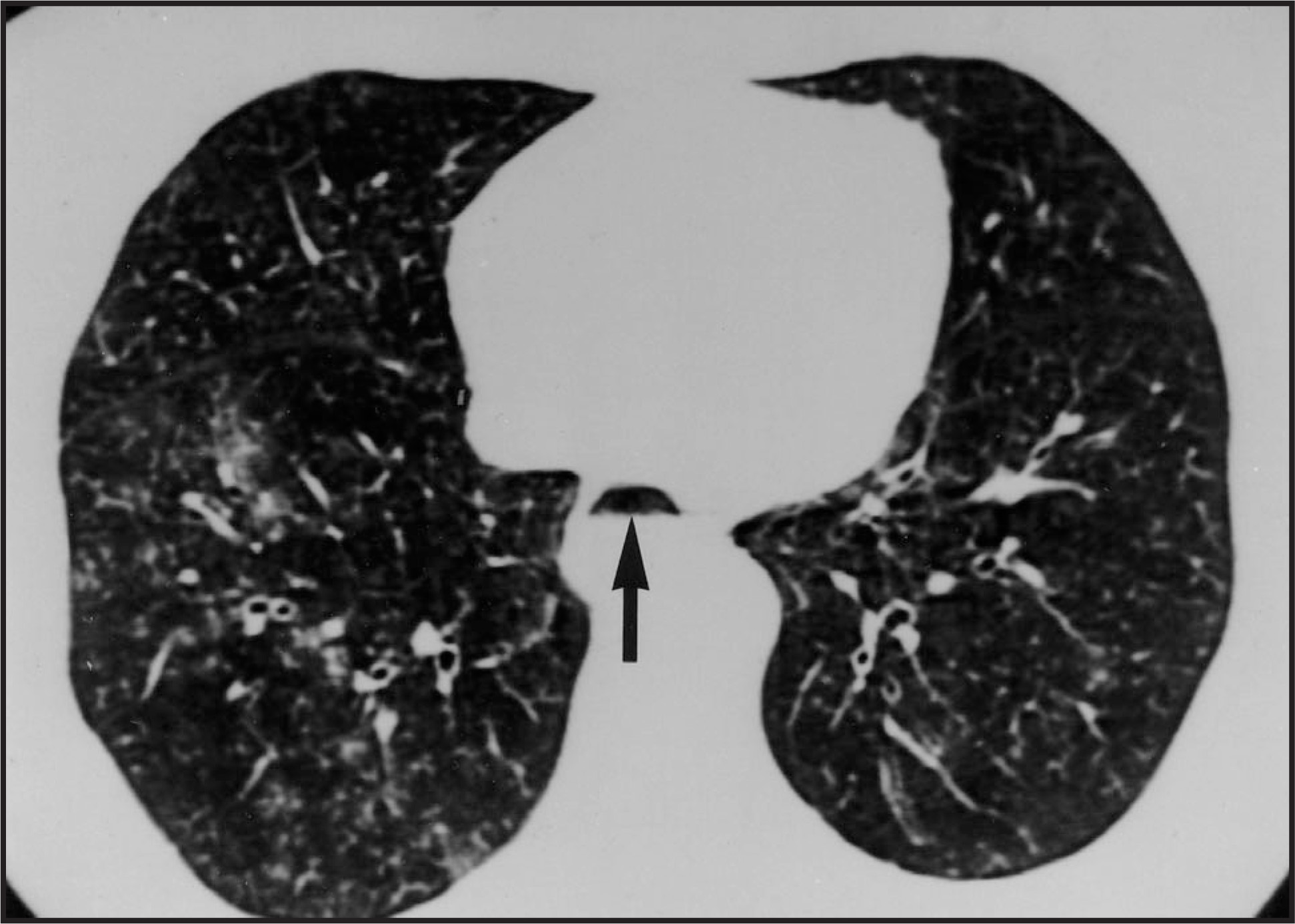 FIGURE 12.