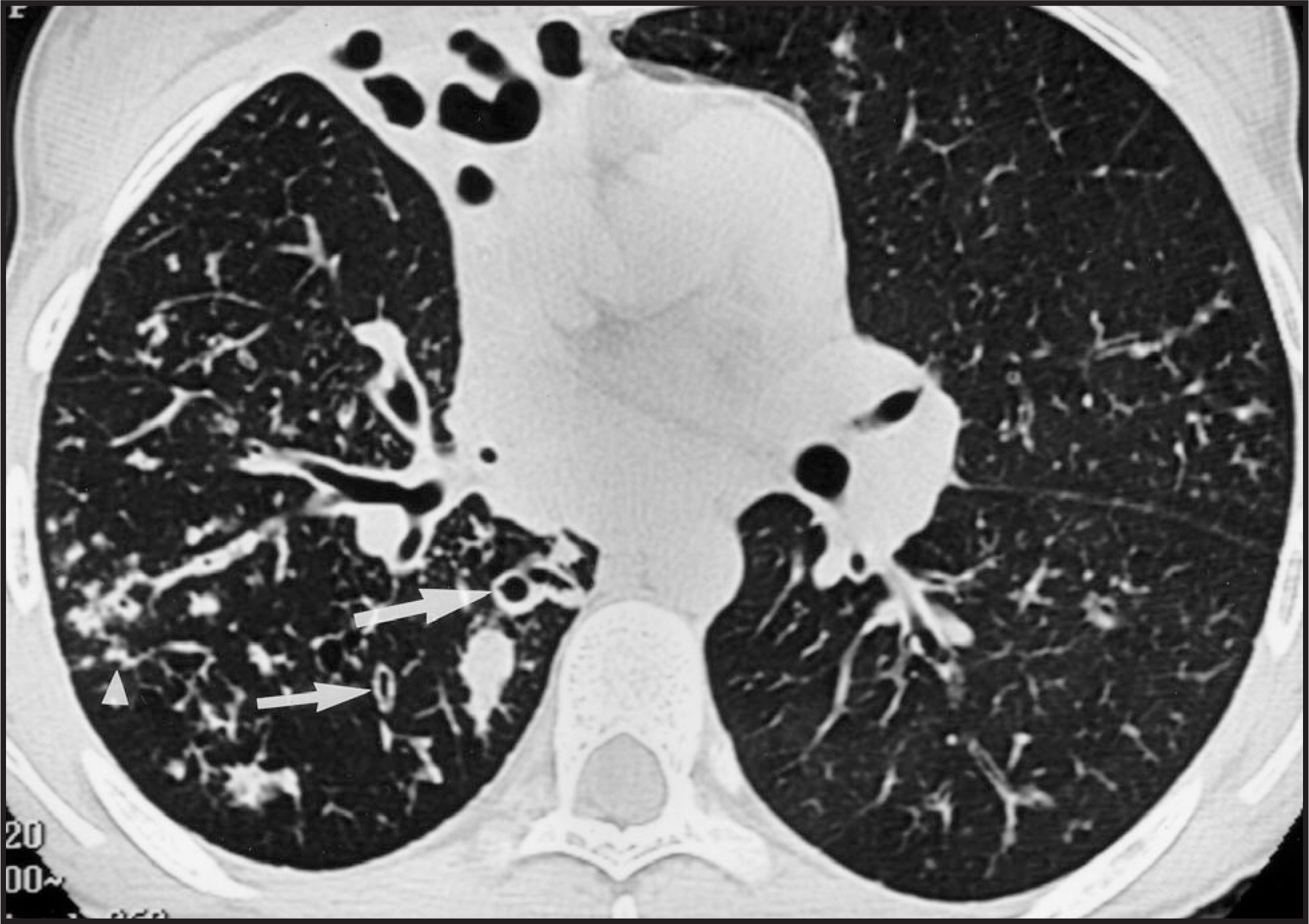 FIGURE 13.