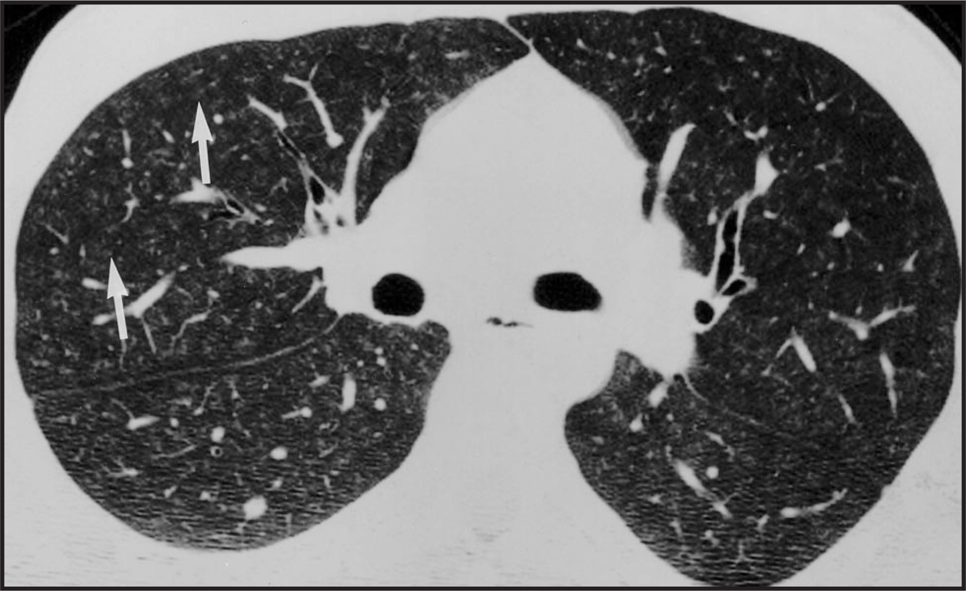 FIGURE 14.