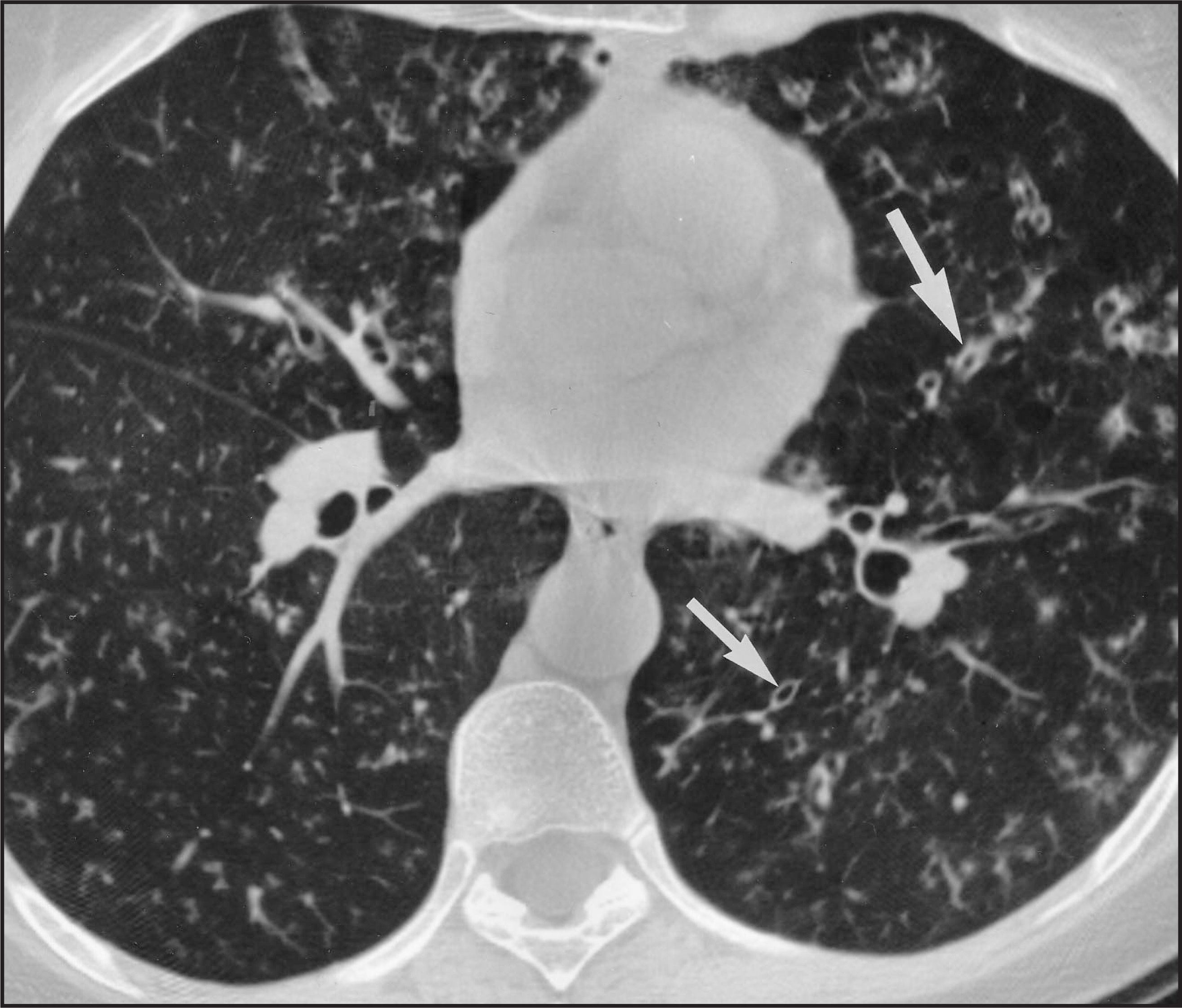FIGURE 17.