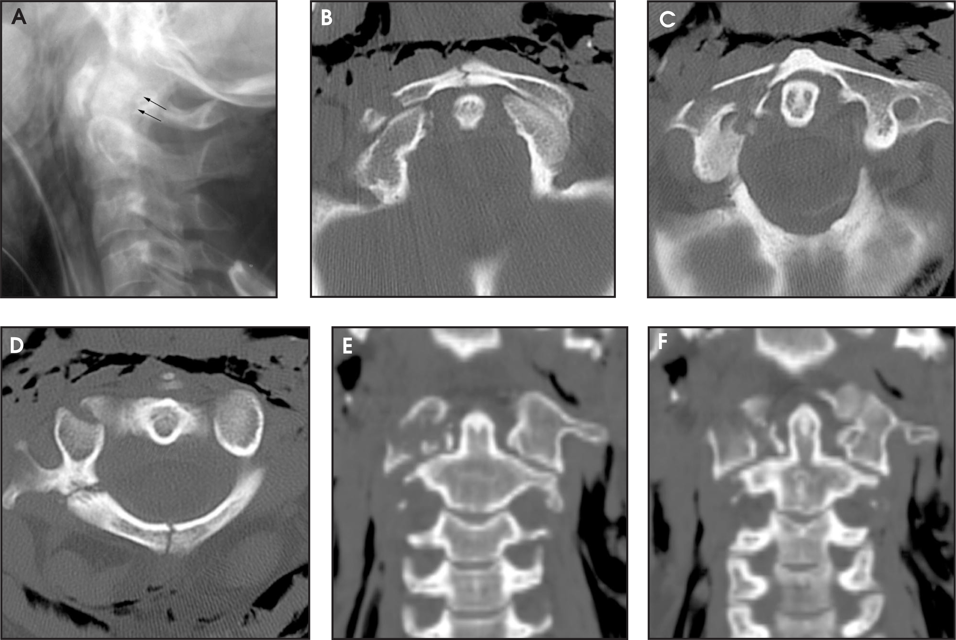 FIGURE 11.