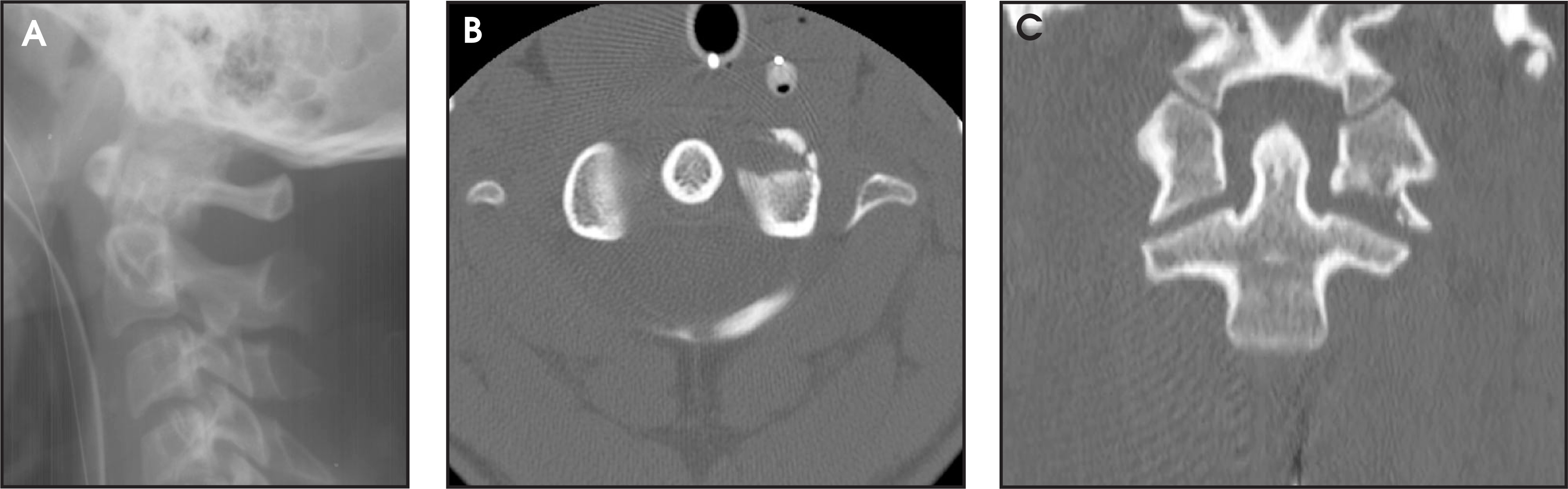 FIGURE 14.