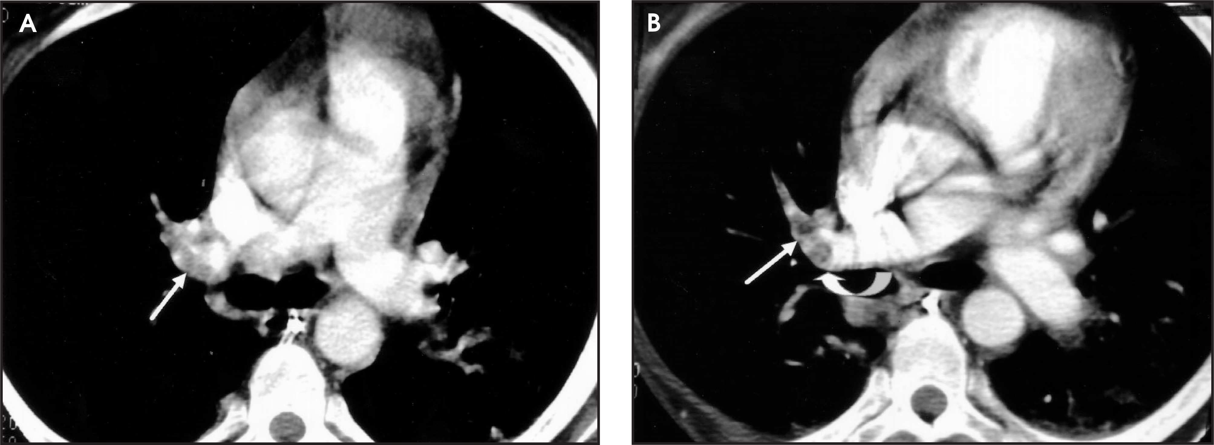 FIGURE 11.