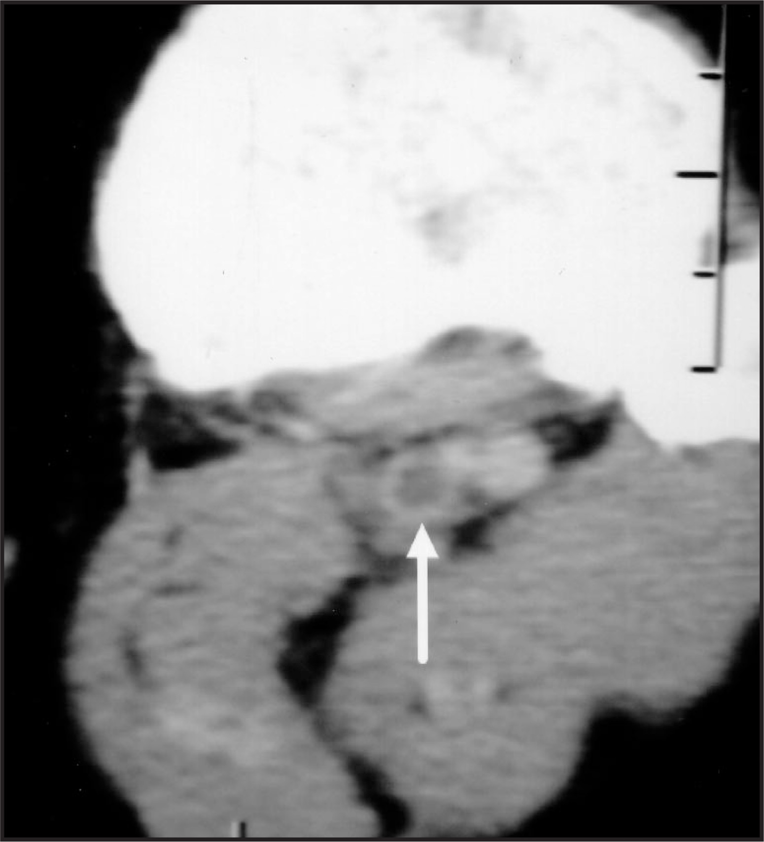 FIGURE 14.