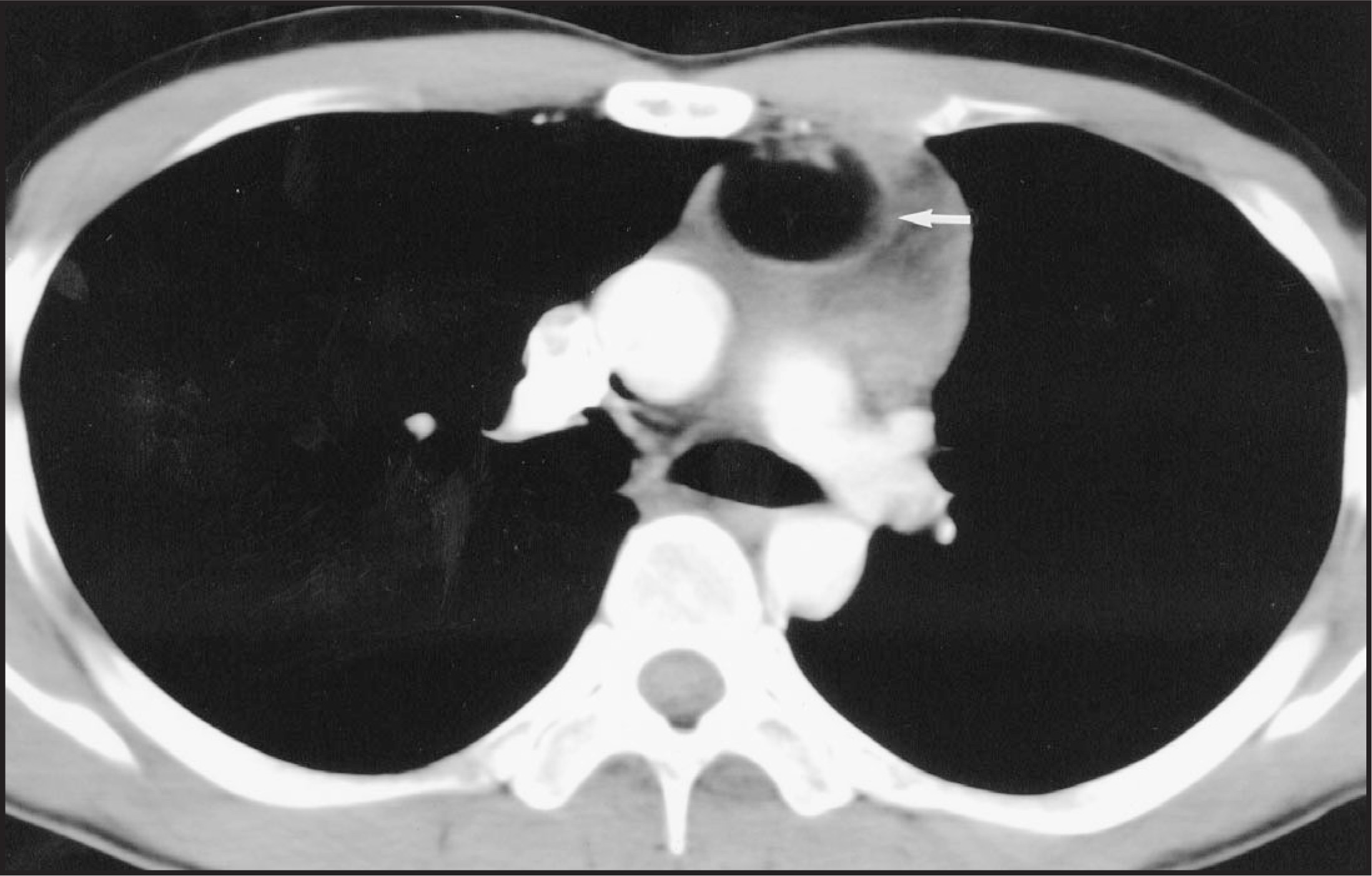 FIGURE 7.