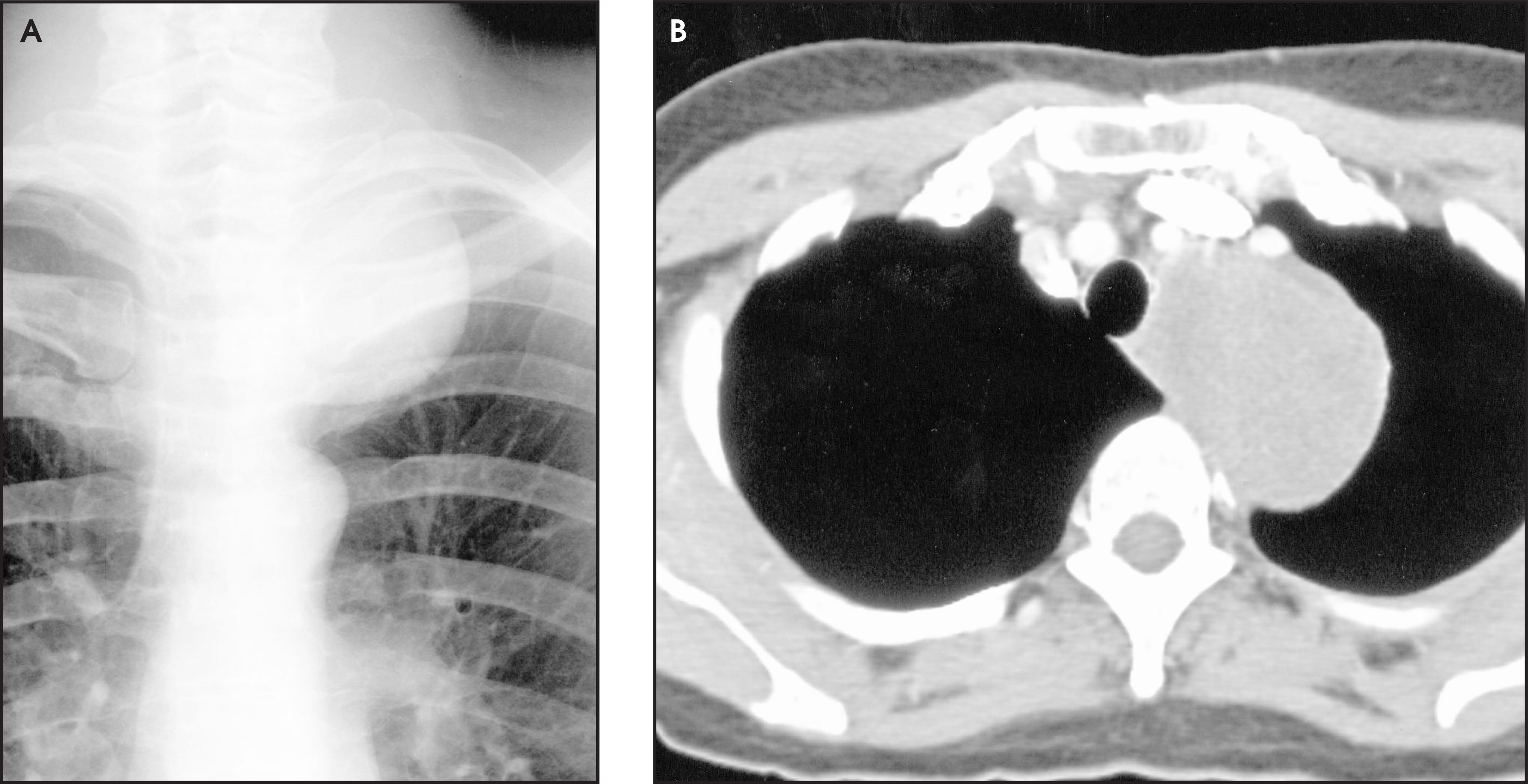 FIGURE 11.