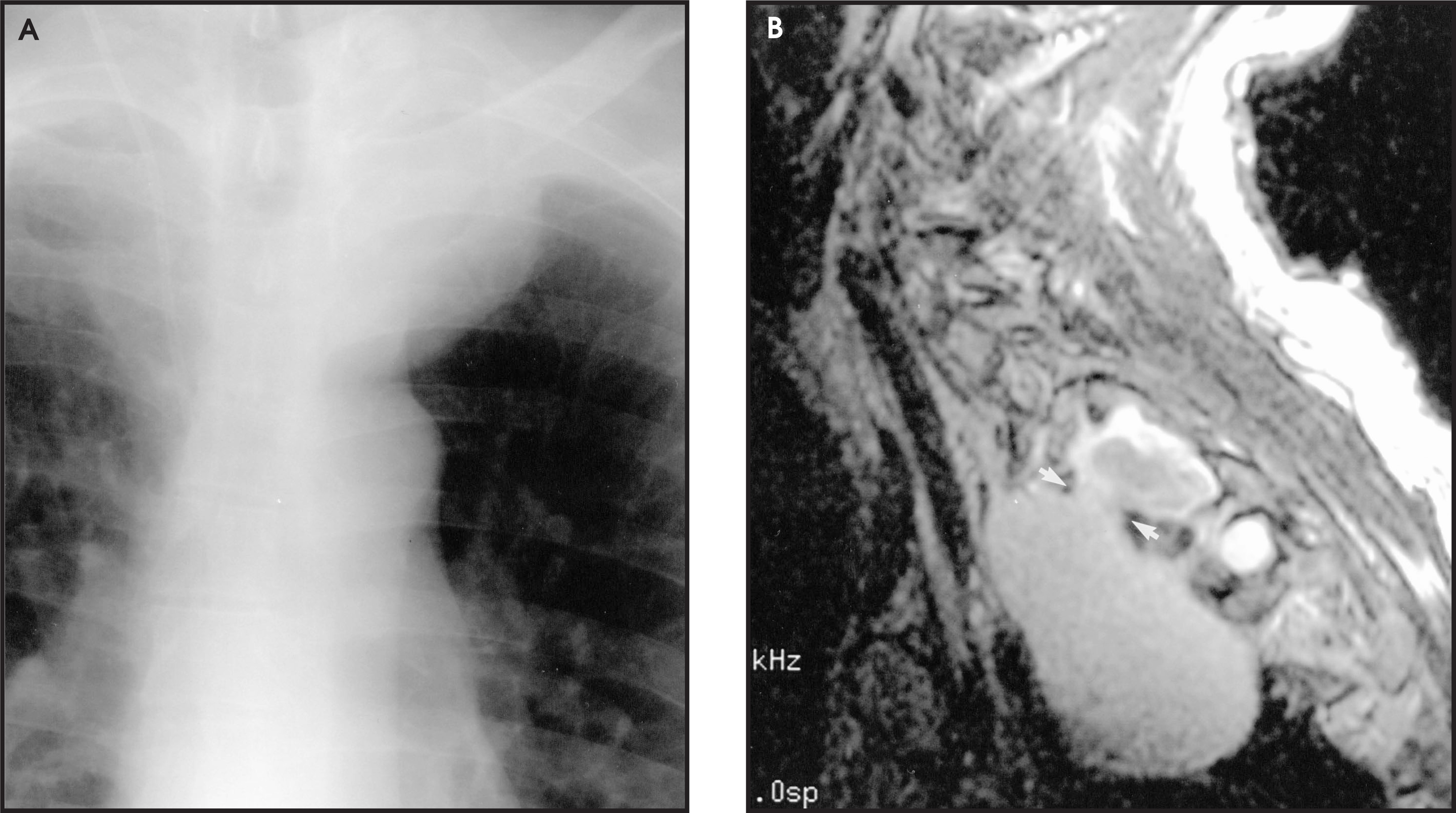 FIGURE 13.