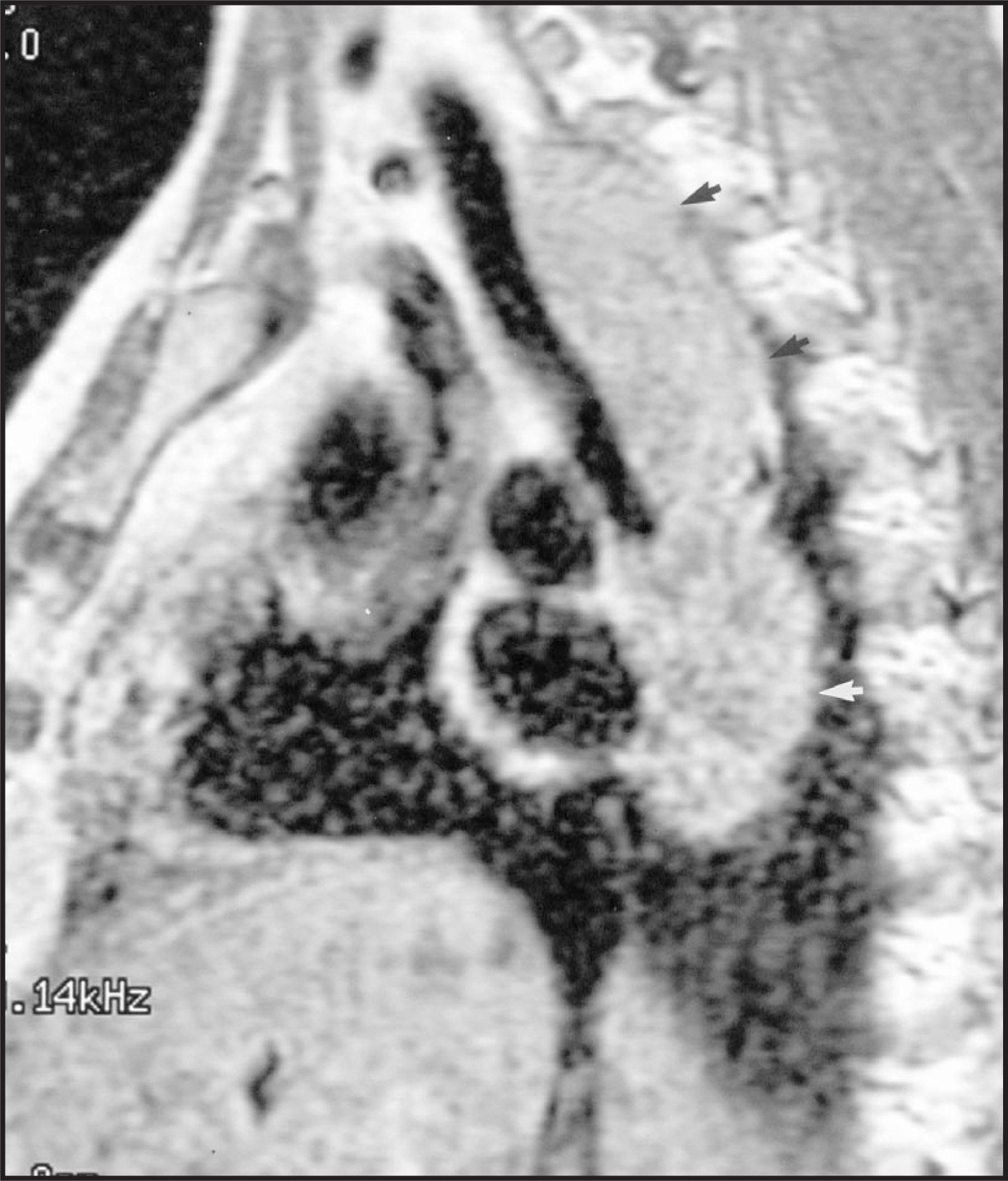 FIGURE 14.