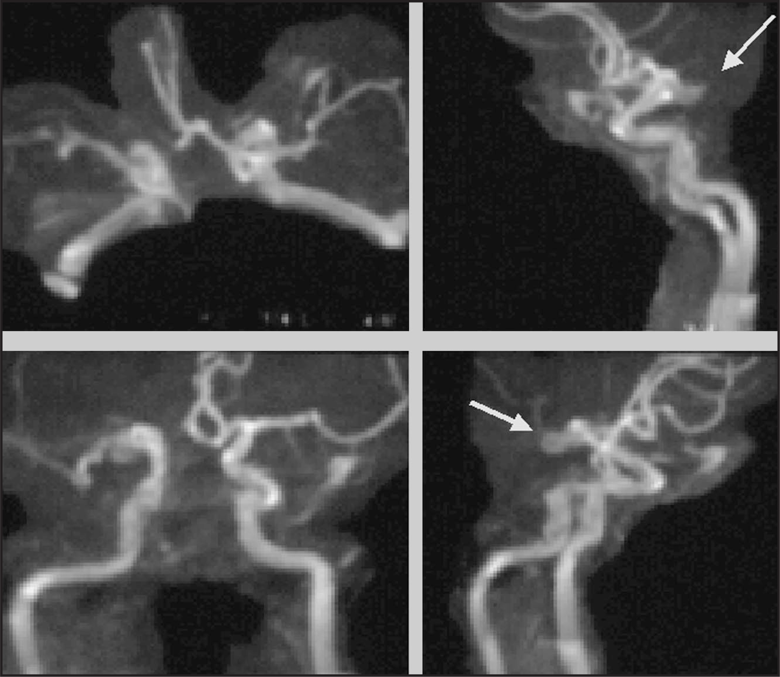FIGURE 3.