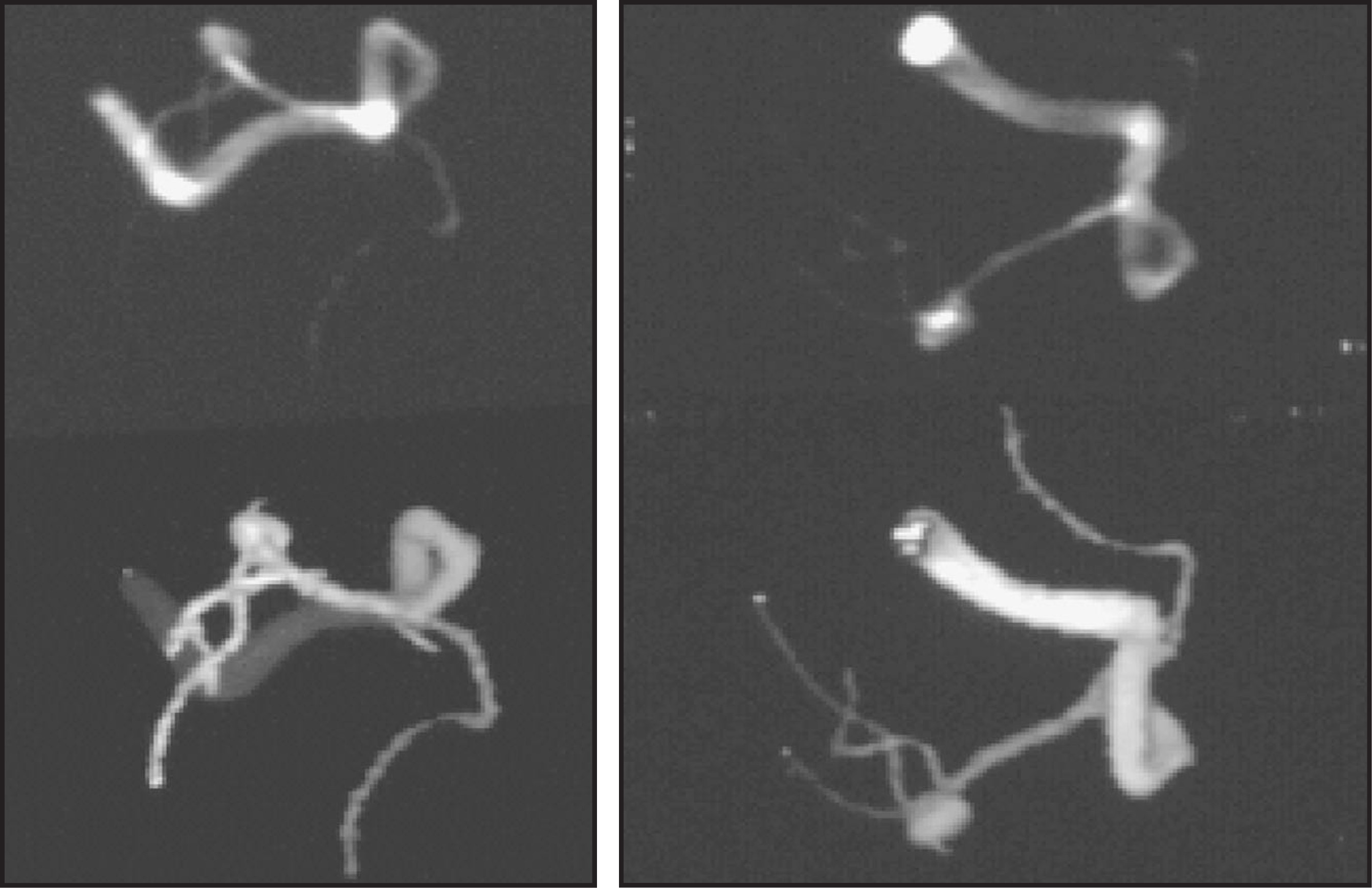 FIGURE 11.