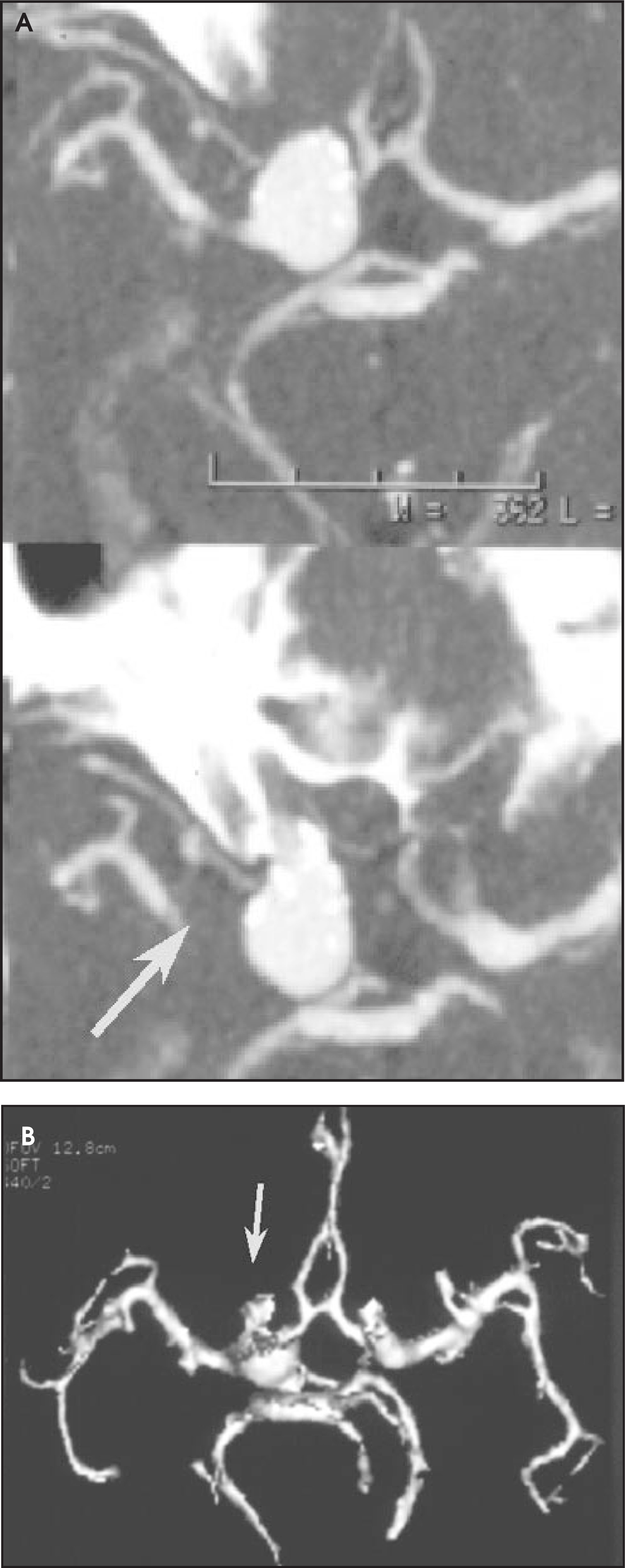 FIGURE 13.