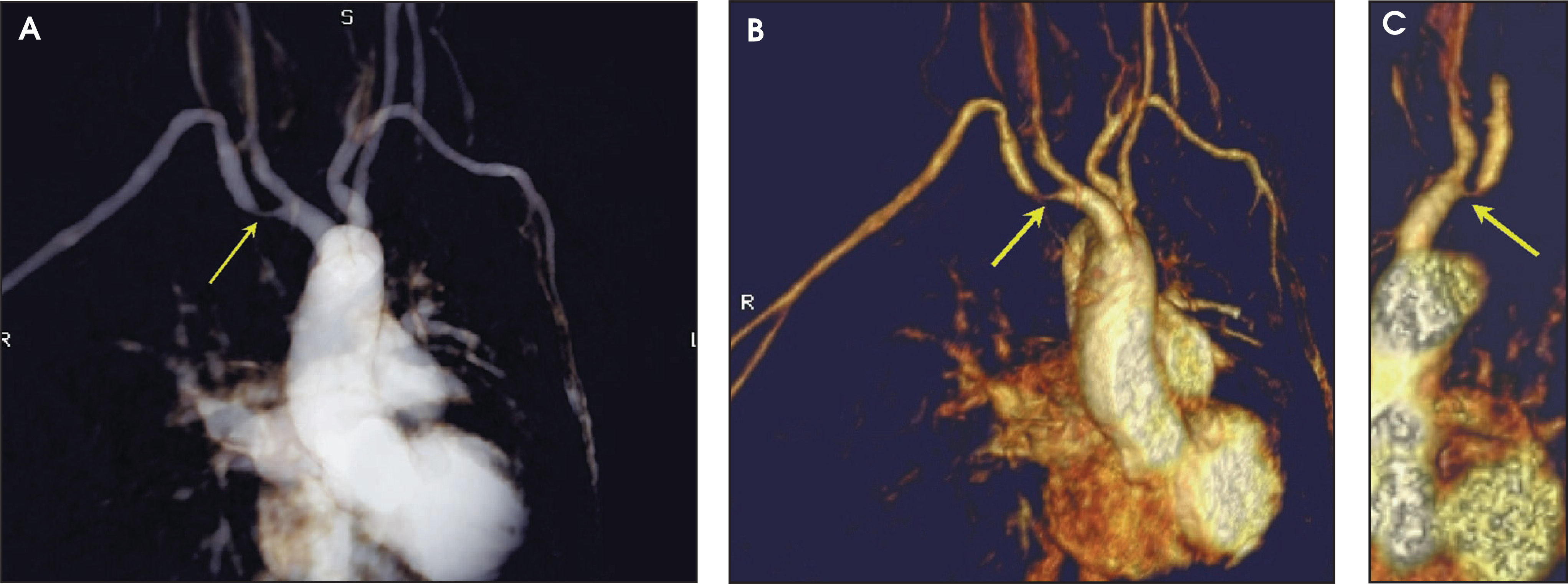 FIGURE 17.