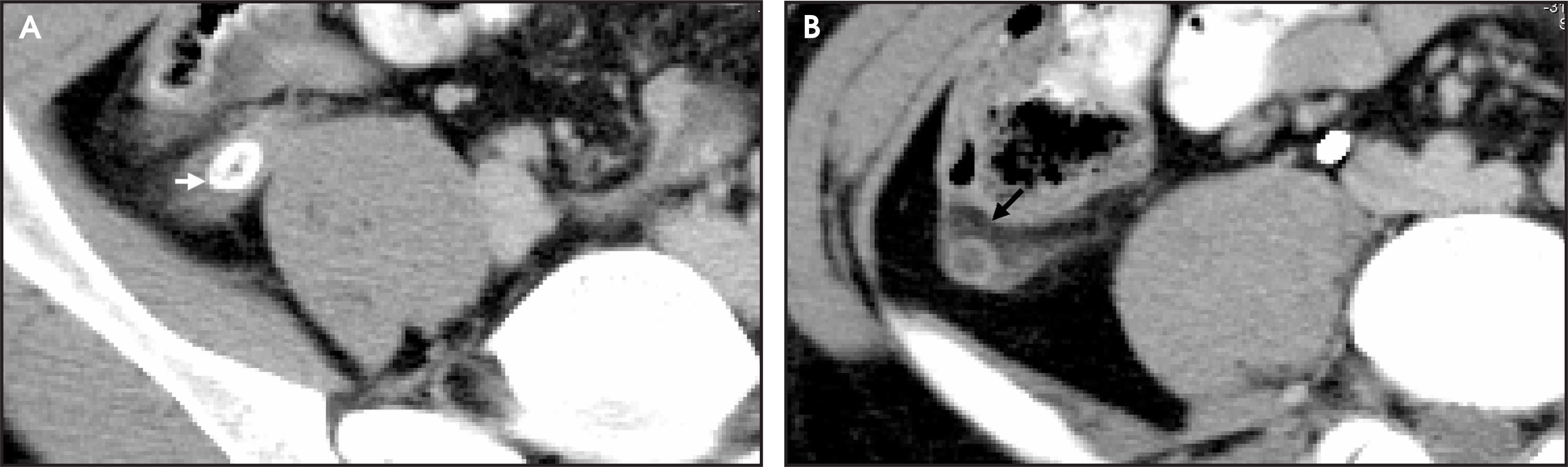FIGURE 11.