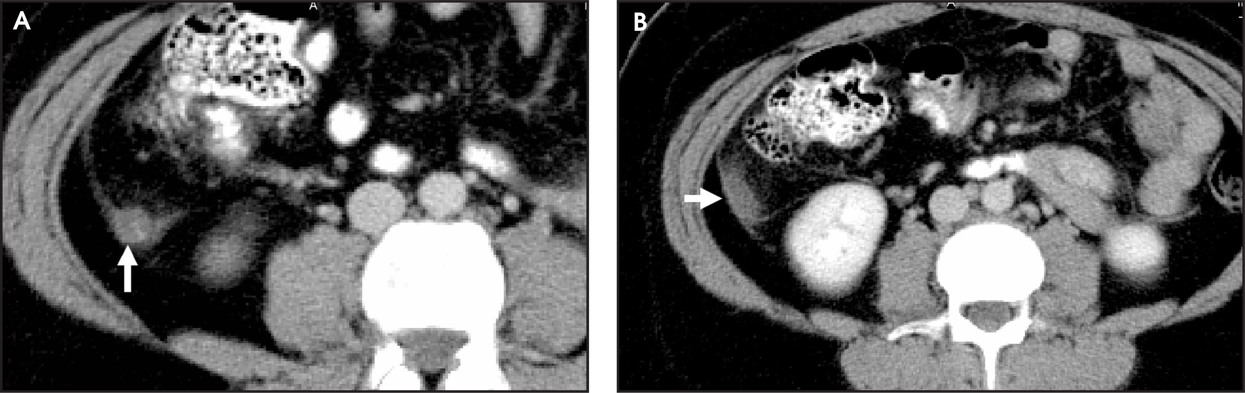 FIGURE 12.