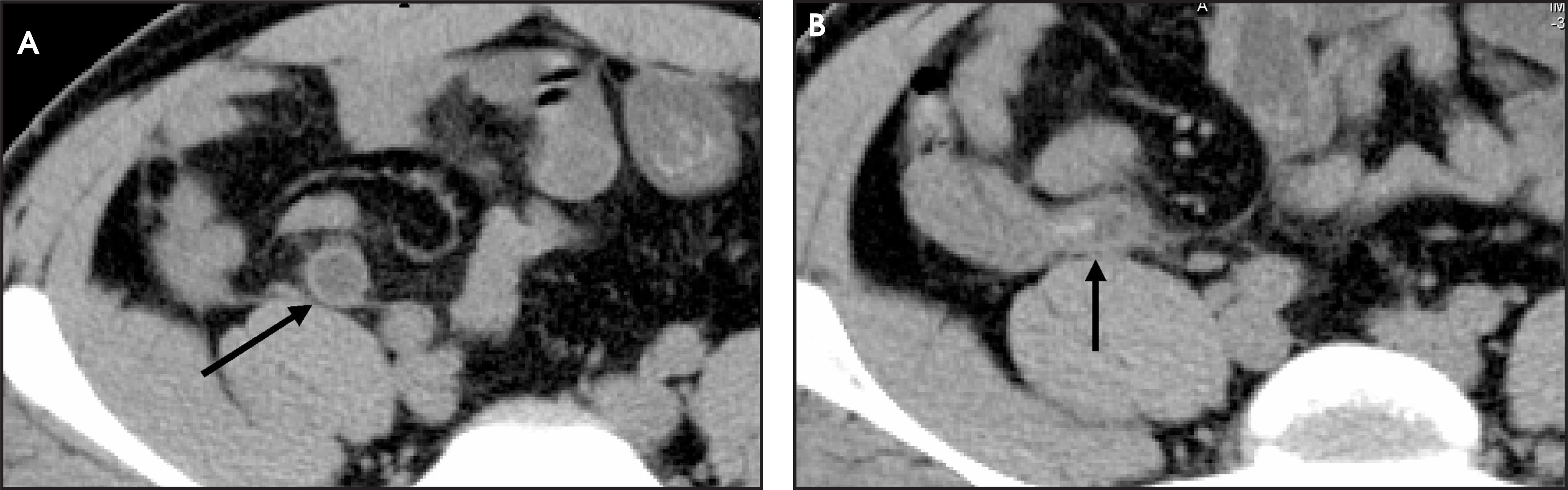 FIGURE 13.