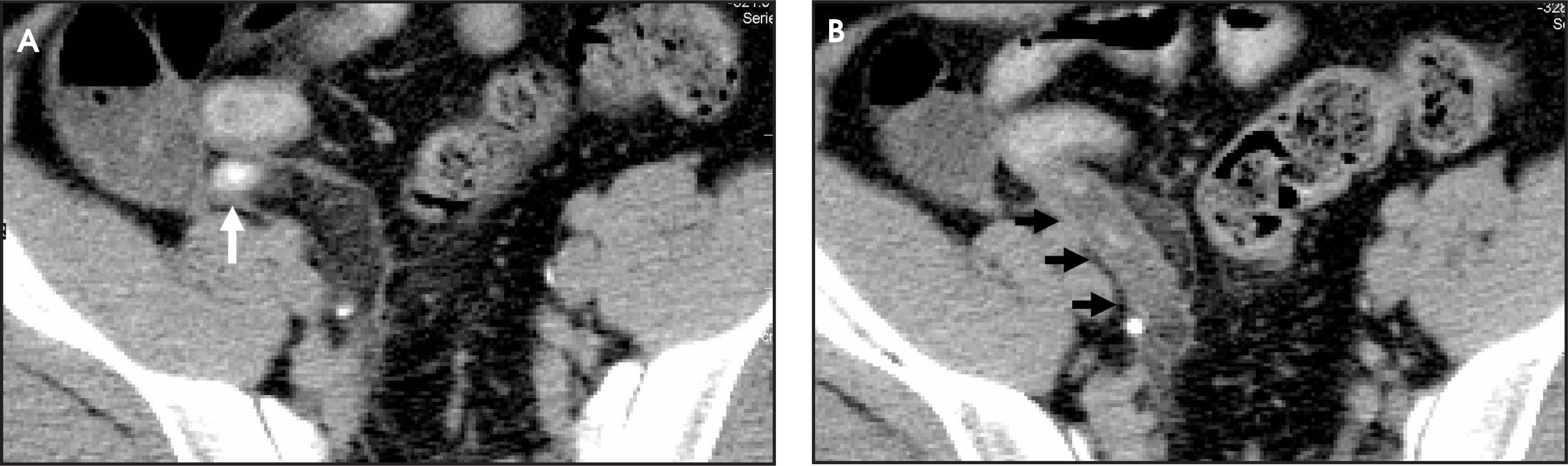 FIGURE 14.