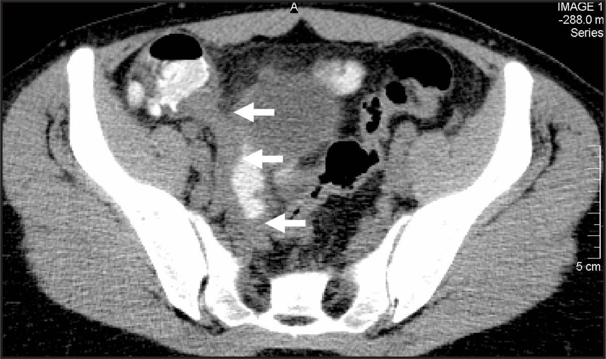 FIGURE 15.