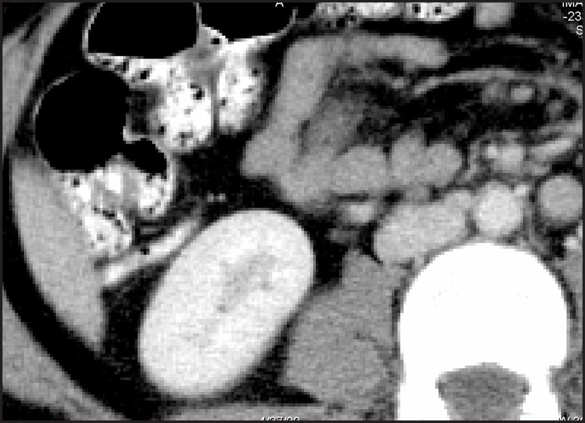FIGURE 17.