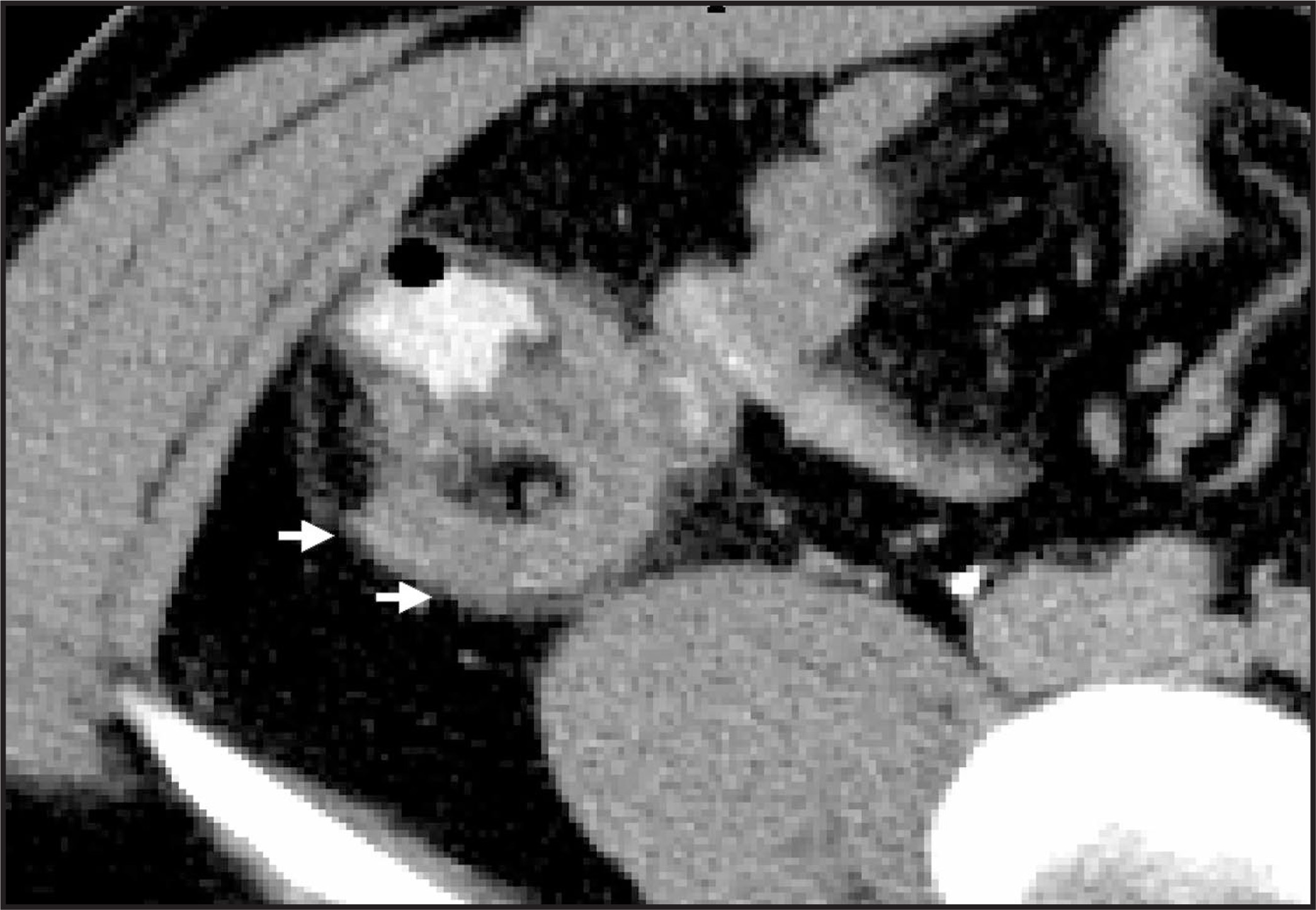 FIGURE 18.