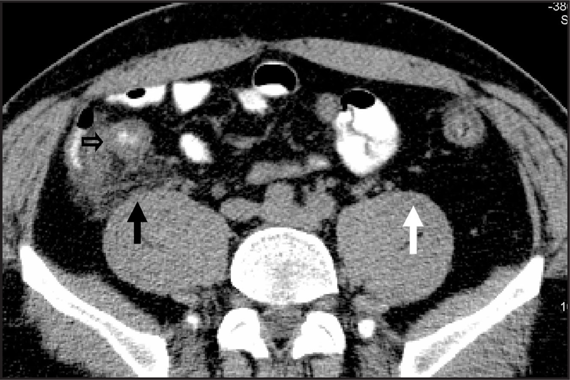 FIGURE 19.